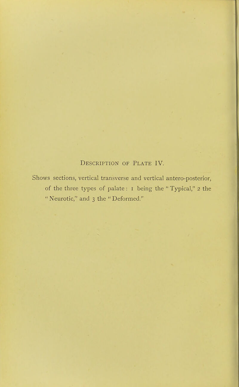 Shows sections, vertical transverse and vertical antero-posterior, of the three types of palate: I being the  Typical, 2 the