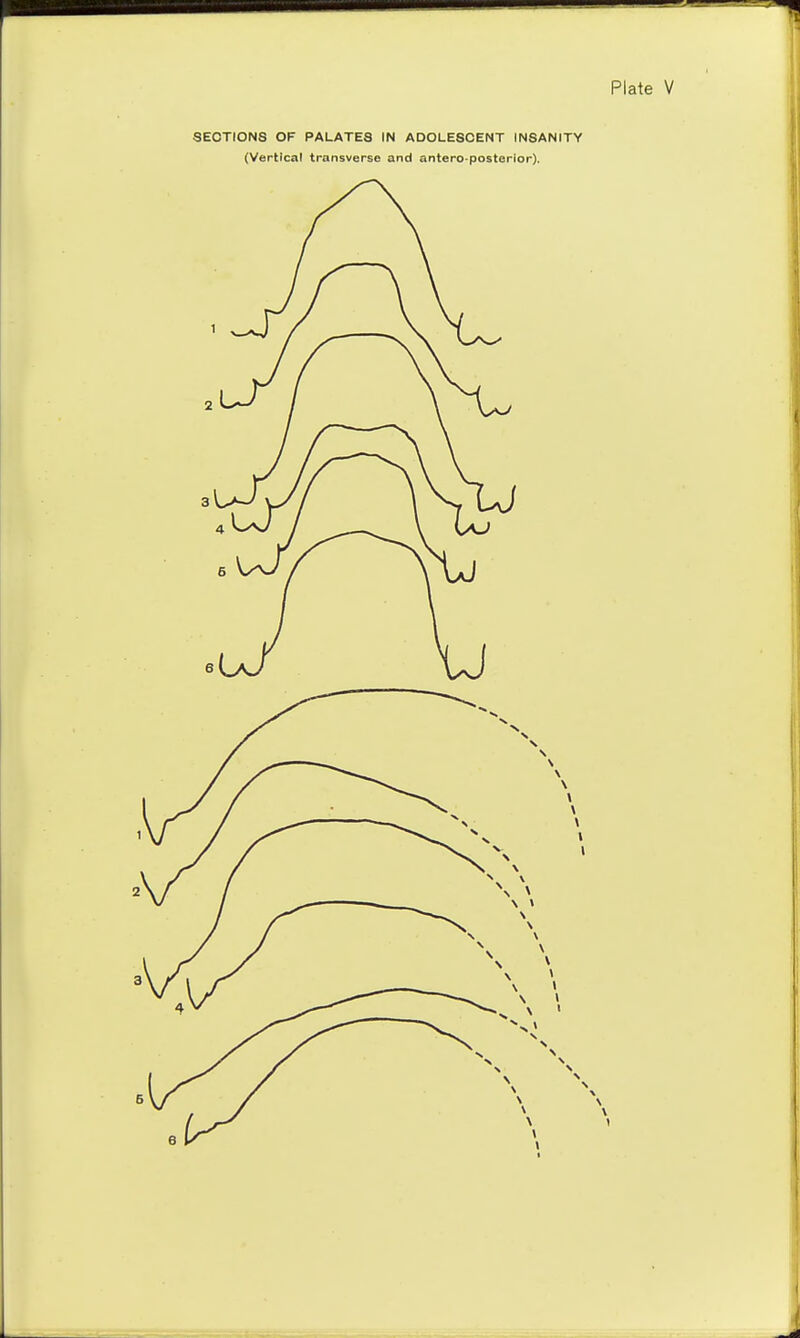 (Vertical transverse and antero posterior).