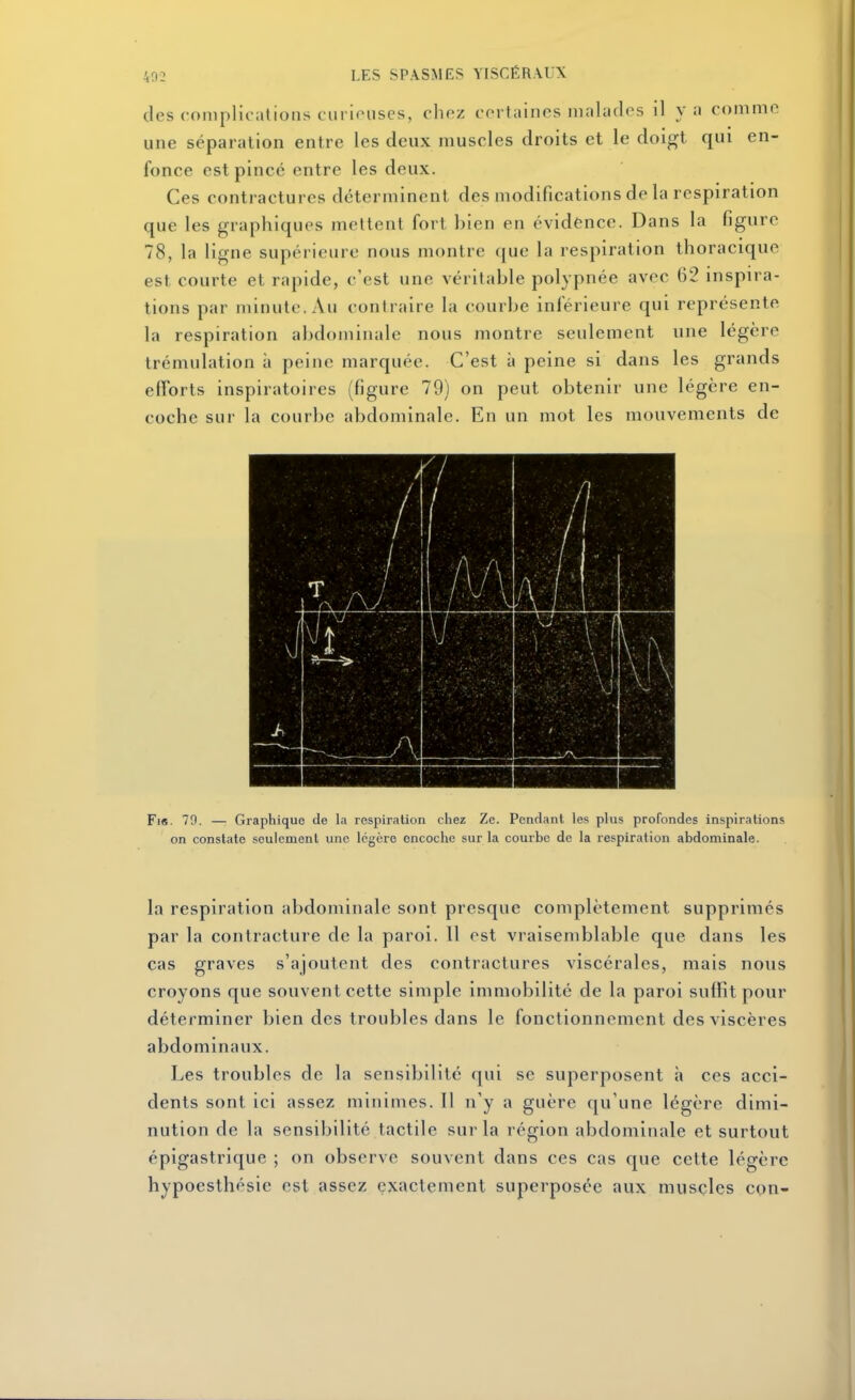 (les complications ciiriouscs, chez certaines malades il va comme une séparation entre les deux muscles droits et le doigt qui en- fonce est pince entre les deux. Ces contractures déterminent des modifications de la respiration que les graphiques mettent fort bien en évidènce. Dans la figure 78, la ligne supérieure nous montre que la respiration thoracique est courte et rapide, c'est une véritable polypnée avec 62 inspira- tions par minute. Au contraire la courbe inférieure qui représente la respiration abdominale nous montre seulement une légère trémulation à peine marquée. C'est à peine si dans les grands efforts inspiratoires (figure 79) on peut obtenir une légère en- coche sur la courbe abdominale. En un mot les mouvements de Fis. 79. — Graphique de la respiration chez Ze. Pendant les plus profondes inspirations on constate seulement une légère encoche sur la courbe de la respiration abdominale. la respiration abdominale sont presque complètement supprimés par la contracture de la paroi. Il est vraisemblable que dans les cas graves s'ajoutent des contractures viscérales, mais nous croyons que souvent cette simple immobilité de la paroi suffit pour déterminer bien des troubles dans le fonctionnement des viscères abdominaux. Les troubles de la sensibilité qui se superposent h ces acci- dents sont ici assez minimes. Il n'y a guère qu'une légère dimi- nution de la sensibilité tactile sur la région abdomiiuile et surtout épigastrique ; on observe souvent dans ces cas que cette légère hypoesthésie est assez exactement superposée aux muscles cpn-