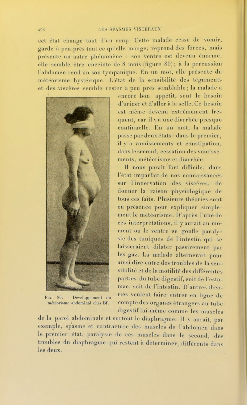 cet état change tout triiii coup. Cette malade ce-.se de vomir, garde à peu près tout ce qu'elle mange, reprend des forces, mais présente un autre phénomène : son ventre est devenu énorme, elle semble èlre enceinte de 8 mois (figure 80) ; à la percussion Tabdomen rend un son tympanique. l^^n un mot, elle présente du météorisme hystérique. L'état de la sensibilité des téguments et des viscères semble rester à peu près semblable; la malade a encore bon appétit, sent le besoin d'uriner et d'aller ii la selle. Ce besoin est même devenu extrêmement (ré- (jueiit, car il y a une diarrhée presque continuelle. En un mot, la malade passe par deux états : dans le premier, il y a vomissements et constipation, dans le second, cessation des vomisse- ments, météorisme et diarrhée. Il nous paraît fort dillicile, dans l'état imparfait de nos connaissances sur l'innervation des viscères, de donner la raison physiologique de tous ces faits. Plusieurs théories sont en présence pour expliquer simple- ment le météorisme. D'après l'une de ces interprétations, il y aurait au mo- ment ou le ventre se gonfle paraly- sie des tuniques de l'intestin qui se laisseraient dilater passivement par les gaz. La malade alternerait pour ainsi dire entre des troubles de la sen- sibilité et de la motilité des différentes parties du tube digestif, soit de l'esto- mac, soit de l'intestin. D'autres théo- ries veulent Aiire entrer en ligne de compte des organes étrangers au tube digestif lui-même comme les muscles de la paroi abdominale et surtout le diaphragme. Il y aurait, par exemple, spasme et contracture des muscles de l'abdomen dans le premier état, paralysie de ces muscles dans le second, des troubles du diaphragme (|ui restent ;i déterminer, différents dans les deux. FiG. MU. — L)i'\elujj[iciiu'iil Au météorisme abdominal cliez Bf.