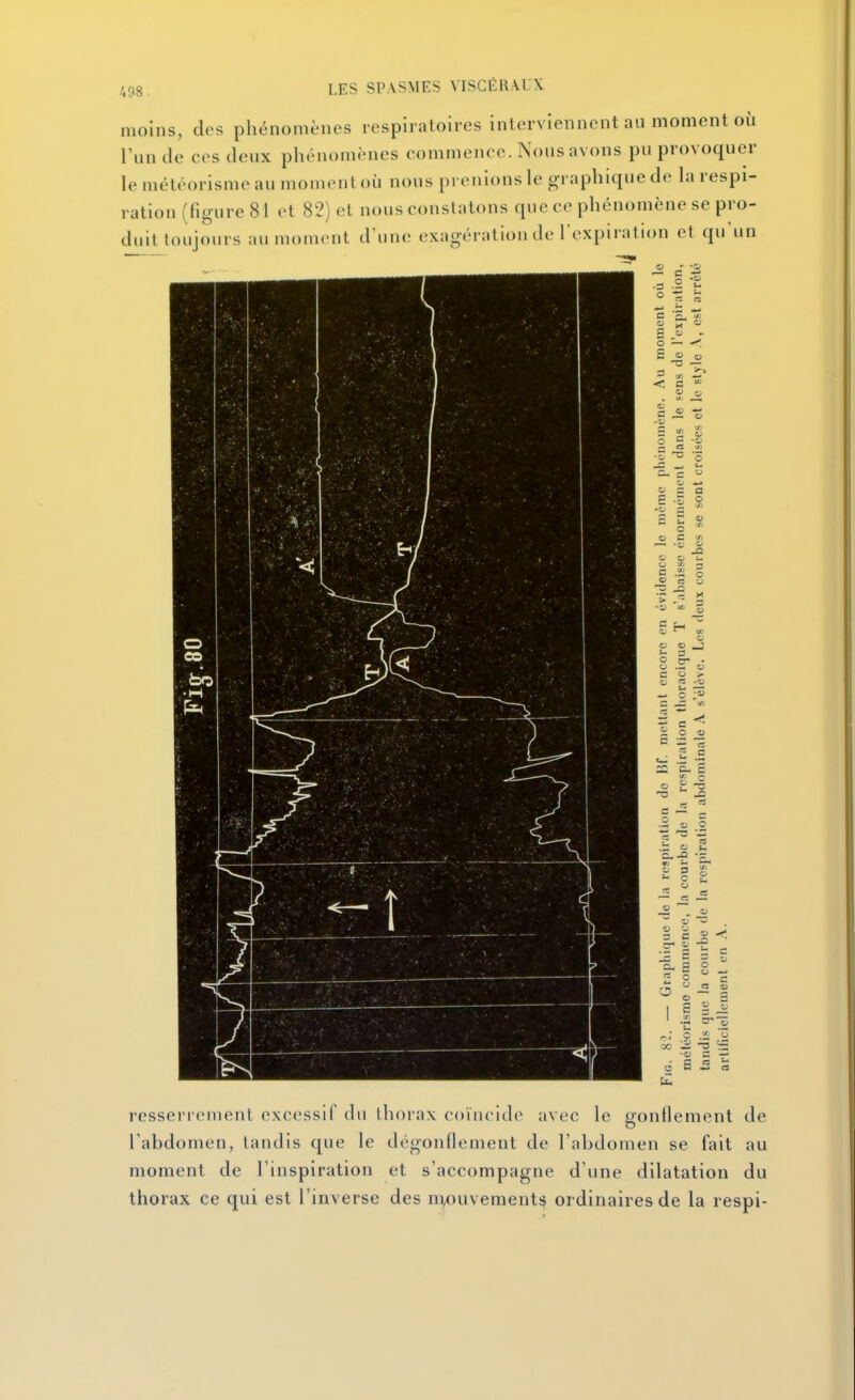 moins, des phénomènes respiratoires interviennent an moment où l'un de ces deux phénomènes commence. Nous avons pu provoquer le météorisme au moment où nous prenions le graphique de la respi- ration (figure 81 et 82) et nous constatons que ce phénomène se pro- duit toujours au moment d'une exagération de l'expiration et qu'un resserrement excessif du thorax coïncide avec le gonflement de l'abdomen, tandis que le dégonflement de l'abdomen se fait au moment de l'inspiration et s'accompagne d'une dilatation du thorax ce qui est l'inverse des m^uvement^ ordinaires de la respi-