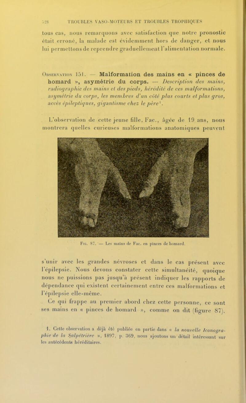 tous cas, nous leniaïquons avec satisfaction que notre pronostic était erroné, la malade est évidemment hoi's de danger, et nous lui permettons de reprendre graduellement l'alimentation normale. Observation 151. — Malformation des mains en « pinces de homard », asymétrie du corps. — Description des miiins, radio(/r;i/)/iie des mains cl des pieds, hêrêdilé de ces nialfornialions, asymétrie du corps, les membres d'un côté plus courts el plus gros, accès épilepliques, gigantisme chez le père^. L'observation de cette jeune fdle, Fac., âgée de 19 ans, nous montrera quelles curieuses malformations anatomiques peuvent Fra. 87. — Les mains de Fac. en pinces de liomard. s'unir avec les grandes névroses et dans le cas présent avec l'épilepsie. Nous devons constater cette simultanéité, quoique nous ne puissions pas jusqu'à présent indiquer les rapports de dépendance qui existent certainement entre ces malformations et l'épilepsie elle-même. Ce qui frappe au premier abord cbez cette personne, ce sont ses mains en « pinces de homard », comme on dit (figure 87). 1. Cette observation a déjà été publiée en partie dans « la nouvelle Iconogra- phie de la Sal/jètrière », 1897, p. 369, nous ajoutons un détail intéressant sur les antécédents héréditaires.