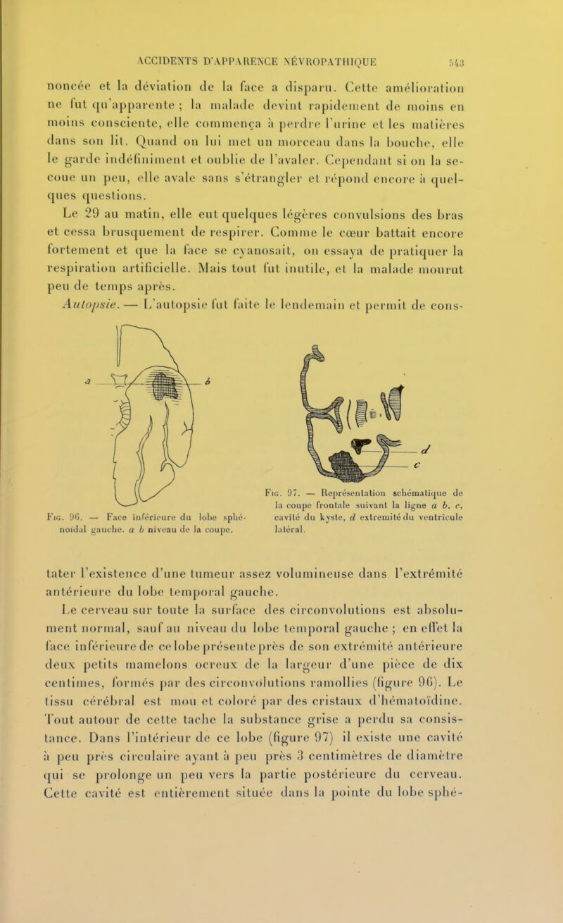 noncée et la déviation de la face a disparu. Cette amélioration ne fut qu'apparente ; la malade devint rapidement de moins en moins consciente, elle commença à perdre Turine et les matières dans son lit. Quand on lui met un morceau dans la bouche, elle le garde indéfiniment et oublie de l'avaler. Cependant si on la se- coue un peu, elle avale sans s'étrangler et répond encore à quel- ques questions. Le 29 au matin, elle eut quelques légères convulsions des bras et cessa brusquement de respirer. Comme le cœur battait encore fortement et que la face se cyanosait, on essaya de pratiquer la respiration artificielle. Mais tout fut inutile, et la malade mourut peu de temps après. Autopsie.— L'autopsio fut faite le lendemain et permit de cons- noidul gauclie. « b niveau cU- la coupe. latéral. tater l'existence d'une tumeur assez volumineuse dans l'extrémité antérieure du lobe temporal gauche. Le cerveau sur toute la surface des circonvolutions est absolu- ment normal, sauf au niveau du lobe temporal gauche ; en ellet la lace inférieure de ce lobe présente près de son extrémité antérieure deux petits mamelons ocreux de la largeur d'une pièce de dix centimes, formés par des circonvrtlutions ramollies (ligure 90). Le tissu cérébral est mou et coloré par des cristaux d'hématoïdine. Tout autour de cette tache la substance grise a perdu sa consis- tance. Dans l'intérieur de ce lobe (figure 97) il existe une cavité à peu près ciiculaire ayant à peu près 3 centimètres de diamètre qui se prolonge un peu vers la partie postéiieure du cerveau. Cette cavité est entièrement située dans la pointe du lobe sphé-
