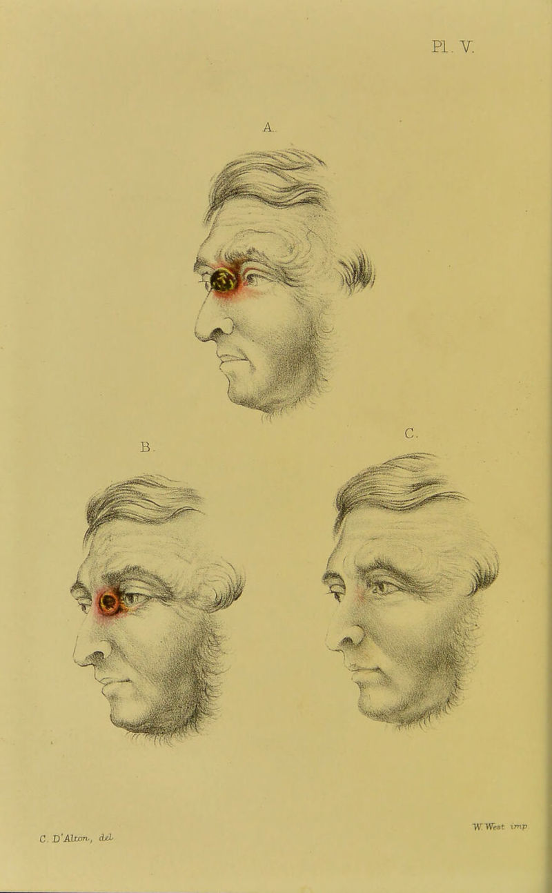 PI. Y. C. D'AUon-, Acl W.WeBt imp