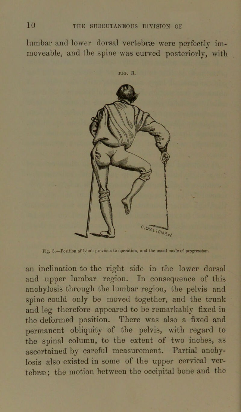 lumbai- and lower dorsal vertebras were perfectly im- moveable, and the spine was curved posteriorly, with FIG. 3. Fig. 3.—Position of Limb previous to operation, and the usual mode of progression. an inclination to the right side in the lower dorsal and upper lumbar region. In consequence of this anchylosis through the lumbar region, the pelvis and spine could only be moved together, and the trunk and leg therefore appeared to be remarkably fixed in the deformed position. There was also a fixed and permanent obliquity of the pelvis, with regard to the spinal column, to the extent of two inches, as ascertained by careful measurement. Partial anchy- losis also existed in some of the upper cervical ver- tebrie; the motion between the occipital bone and the