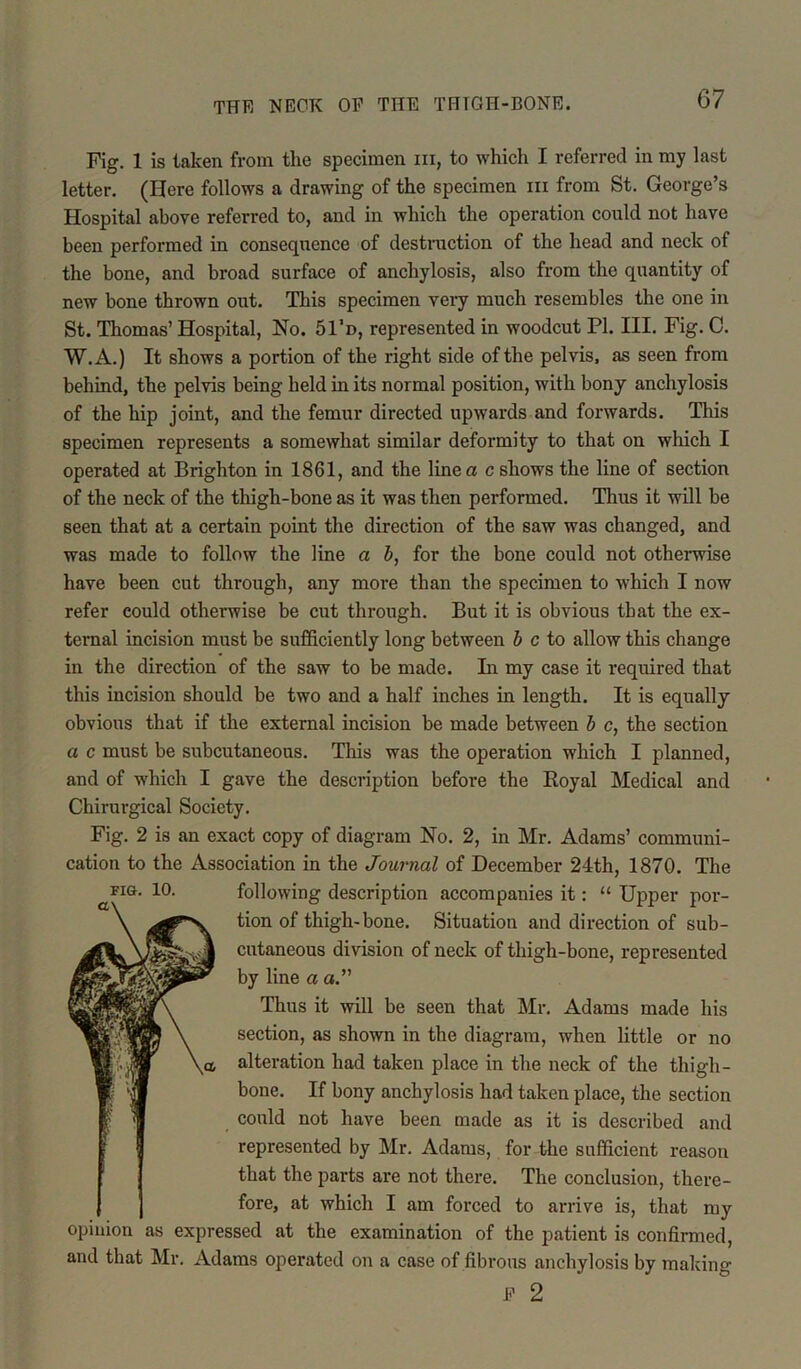 Fig. 1 is taken from the specimen hi, to which I referred in my last letter. (Here follows a drawing of the specimen hi from St. George’s Hospital above referred to, and in which the operation could not have been performed in consequence of destruction of the head and neck of the bone, and broad surface of anchylosis, also from the quantity of new bone thrown out. This specimen very much resembles the one in St. Thomas’ Hospital, No. 51’d, represented in woodcut PI. III. Fig. C. W.A.) It shows a portion of the right side of the pelvis, as seen from behind, the pelvis being held in its normal position, with bony anchylosis of the hip joint, and the femur directed upwards and forwards. This specimen represents a somewhat similar deformity to that on which I operated at Brighton in 1861, and the line a c shows the line of section of the neck of the thigh-bone as it was then performed. Thus it will be seen that at a certain point the direction of the saw was changed, and was made to follow the line a b, for the bone could not otherwise have been cut through, any more than the specimen to which I now refer could otherwise be cut through. But it is obvious that the ex- ternal incision must be sufficiently long between b c to allow this change in the direction of the saw to be made. In my case it required that this incision should be two and a half inches in length. It is equally obvious that if the external incision be made between b c, the section a c must be subcutaneous. This was the operation which I planned, and of which I gave the description before the Royal Medical and Chirurgical Society. Fig. 2 is an exact copy of diagram No. 2, in Mr. Adams’ communi- cation to the Association in the Journal of December 24th, 1870. The FIG. following description accompanies it: “ Upper por- tion of thigh-bone. Situation and direction of sub- cutaneous division of neck of thigh-bone, represented by line a a.” Thus it will be seen that Mr. Adams made his section, as shown in the diagram, when little or no alteration had taken place in the neck of the thigh- bone. If bony anchylosis had taken place, the section could not have been made as it is described and represented by Mr. Adams, for the sufficient reason that the parts are not there. The conclusion, there- fore, at which I am forced to arrive is, that my opinion as expressed at the examination of the patient is confirmed, and that Mr. Adams operated on a case of fibrous anchylosis by making J? 2