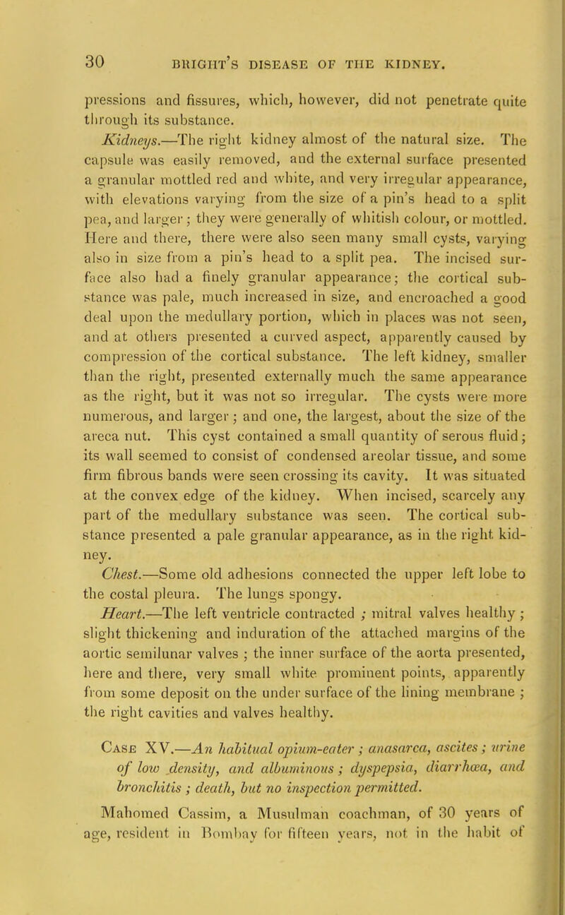 pressions and fissures, which, however, did not penetrate quite through its substance. Kidneys.—The right kidney almost of the natural size. The capsule was easily removed, and the external surface presented a granular mottled red and white, and very irregular appearance, with elevations varying from the size of a pin's head to a split pea, and larger ; they were generally of whitish colour, or mottled. Here and there, there were also seen many small cysts, varying also in size from a pin's head to a split pea. The incised sur- face also had a finely granular appearance; the cortical sub- stance was pale, much increased in size, and encroached a good deal upon the medullary portion, which in places was not seen, and at others presented a curved aspect, apparently caused by compression of the cortical substance. The left kidney, smaller than the right, presented externally much the same appearance as the right, but it was not so irregular. The cysts were more numerous, and larger; and one, the largest, about the size of the areca nut. This cyst contained a small quantity of serous fluid ; its wall seemed to consist of condensed areolar tissue, and some firm fibrous bands were seen crossing its cavity. It was situated at the convex edge of the kidney. When incised, scarcely any part of the medullary substance was seen. The cortical sub- stance presented a pale granular appearance, as in the right kid- ney. Chest.—Some old adhesions connected the upper left lobe to the costal pleura. The lungs spongy. Heart.—The left ventricle contracted ; mitral valves healthy ; slight thickening and induration of the attached margins of the aortic semilunar valves ; the inner surface of the aorta presented, here and there, very small white, prominent points, apparently from some deposit on the under surface of the lining membrane ; the right cavities and valves healthy. Case XV.—An habitual opium-eater; anasarca, ascites; urine of low density, and albuminous ; dyspepsia, diarrhoea, and bronchitis ; death, but no inspection permitted. Mahomed Cassim, a Musulman coachman, of 30 years of age, resident in Bombay for fifteen years, not in the habit of