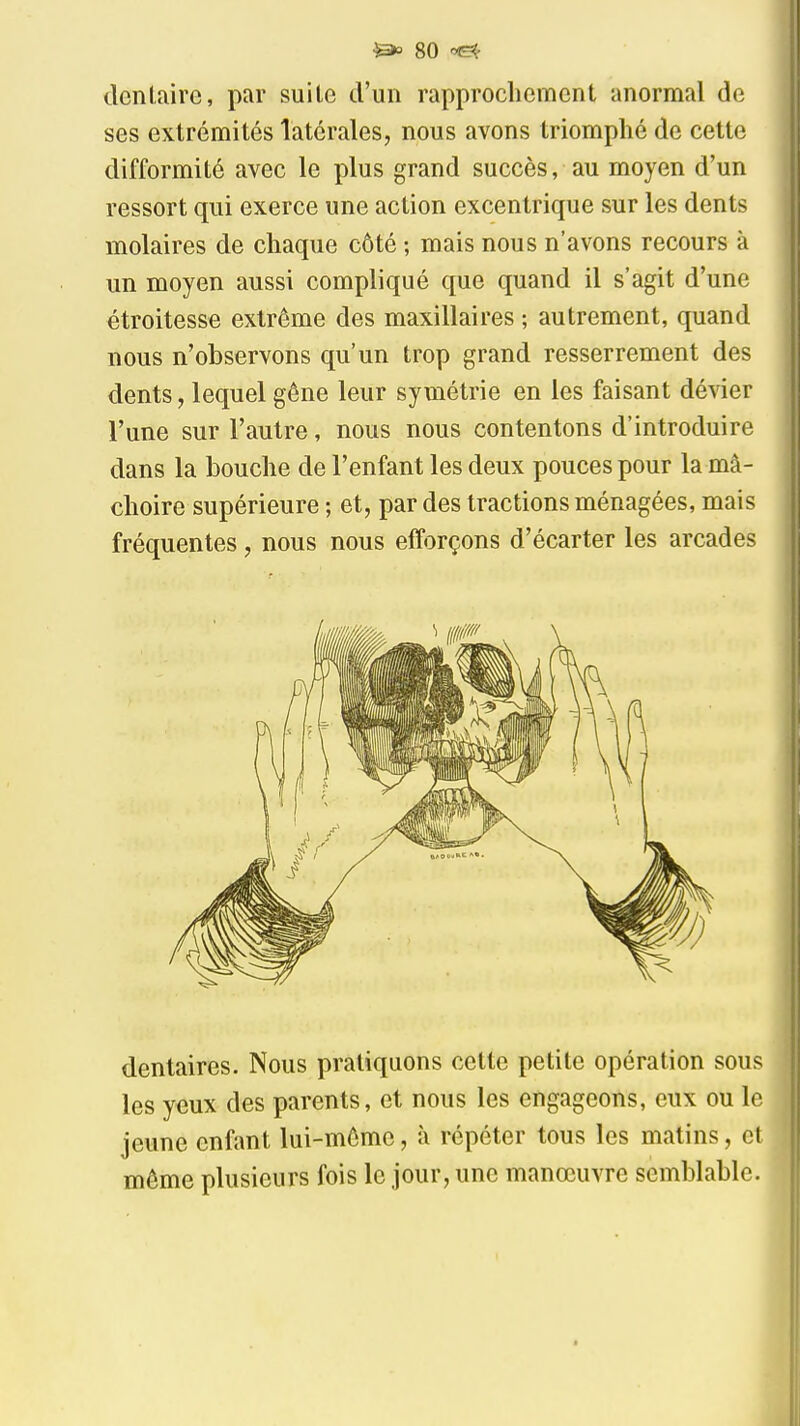 dentaire, par suite d'un rapprochement anormal de ses extrémités latérales, nous avons triomphé de cette difformité avec le plus grand succès, au moyen d'un ressort qui exerce une action excentrique sur les dents molaires de chaque côté ; mais nous n'avons recours à un moyen aussi compliqué que quand il s'agit d'une étroitesse extrême des maxillaires ; autrement, quand nous n'observons qu'un trop grand resserrement des dents, lequel gêne leur symétrie en les faisant dévier l'une sur l'autre, nous nous contentons d'introduire dans la bouche de l'enfant les deux pouces pour la mâ- choire supérieure ; et, par des tractions ménagées, mais fréquentes, nous nous efforçons d'écarter les arcades dentaires. Nous pratiquons cette petite opération sous les yeux des parents, et nous les engageons, eux ou le jeune enfant lui-même, à répéter tous les matins, et même plusieurs fois le jour, une manœuvre semblable.