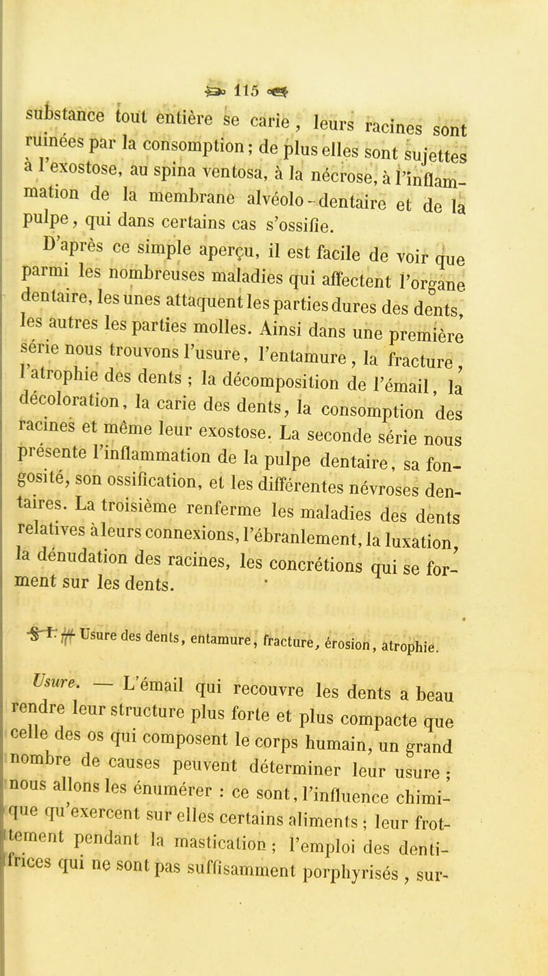 sutstance tout entière se carie, leurs racines sont ruinées par la consomption; de plus elles sont sujettes a 1 exostose, au spina ventosa, à la nécrose, à l'inflam- mation de la membrane alvéole - dentaire et de la pulpe, qui dans certains cas s'ossifie. D'après ce simple aperçu, il est facile de voir que parmi les nombreuses maladies qui affectent l'or-ane dentaire, les unes attaquent les parties dures des dents les autres les parties molles. Ainsi dans une première série nous trouvons l'usure, l'entamure, la fracture, I atrophie des dents ; la décomposition de l'émail, la décoloration, la carie des dents, la consomption des racines et même leur exostose. La seconde série nous présente l'inflammation de la pulpe dentaire, sa fon- gosite, son ossification, et les différentes névroses den- taires. La troisième renferme les maladies des dents relatives àleurs connexions, l'ébranlement, la luxation la dénudation des racines, les concrétions qui se for- ment sur les dents. ■Tf^î^ Usure des dents, entamure, fracture, érosion, atrophie. Usure. _ L'émail qui recouvre les dents a beau rendre leur structure plus forte et plus compacte que celle des os qui composent le corps humain, un grand 'nombre de causes peuvent déterminer leur usure- nous allons les énumérer : ce sont, l'influence chimi- que qu exercent sur elles certains aliments ; leur frot- tement pendant la mastication; l'emploi des denti- Irices qui ne sont pas suffisamment porphyrisés , sur-