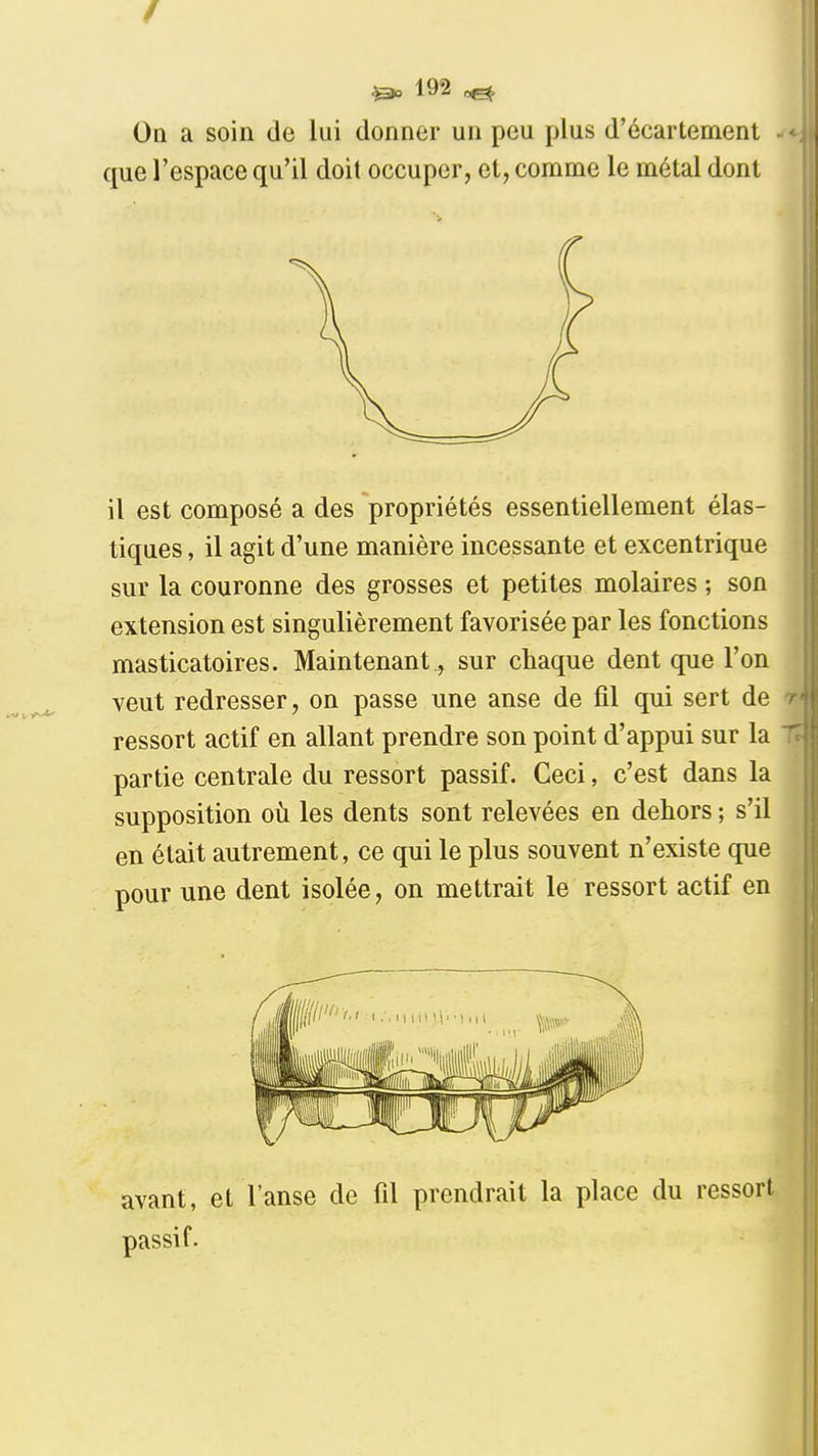 9 ^ 192 ^ On a soin de lui donner un peu plus d'écartement . que l'espace qu'il doit occuper, et, comme le métal dont il est composé a des propriétés essentiellement élas- tiques , il agit d'une manière incessante et excentrique sur la couronne des grosses et petites molaires ; son extension est singulièrement favorisée par les fonctions masticatoires. Maintenant, sur chaque dent que l'on veut redresser, on passe une anse de fil qui sert de ressort actif en allant prendre son point d'appui sur la partie centrale du ressort passif. Ceci, c'est dans la supposition oti les dents sont relevées en dehors ; s'il en était autrement, ce qui le plus souvent n'existe que pour une dent isolée, on mettrait le ressort actif en avant, et l'anse de fil prendrait la place du ressort passif.