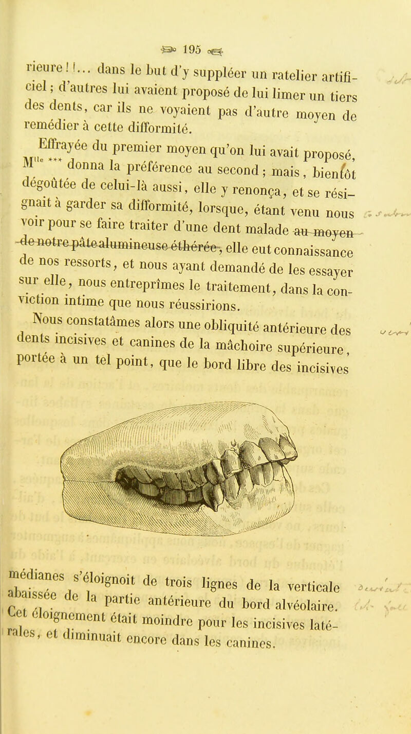 rieiire ! !... dans le but d'y suppléer un râtelier artifi- ciel ; d autres lui avaient proposé de lui limer un tiers des dents, car ils ne voyaient pas d'autre moyen de remédier à cette difformité. ^T^'' ^^^^^ lui avait proposé, M donna la préférence au second ; mais, bienfet dégoûtée de celui-là aussi, elle y renonça, et se rési- -'^^ j iciiuiiya, ei se resi- gnaita garder sa difformité, lorsque, étant venu nous a^^. voir pour se faire traiter d'une dent malade ^moy^-^ -4^flotre^âl^alumineuse étbérée-, elle eut connaissance de nos ressorts, et nous ayant demandé de les essayer sur elle, nous entreprîmes le traitement, dans la con- viction intime que nous réussirions. Nous constatâmes alors une obliquité antérieure des dents mcisives et canines de la mâchoire supérieure portée à un tel point, que le bord libre des incisives' ltT\ ''''' ^^^^^ 1^ --«cale abais ee de la partie antérieure du bord alvéolaire. tet eloignement était moindre pour les incisives laté- rales, et diminuait encore dans les canines.