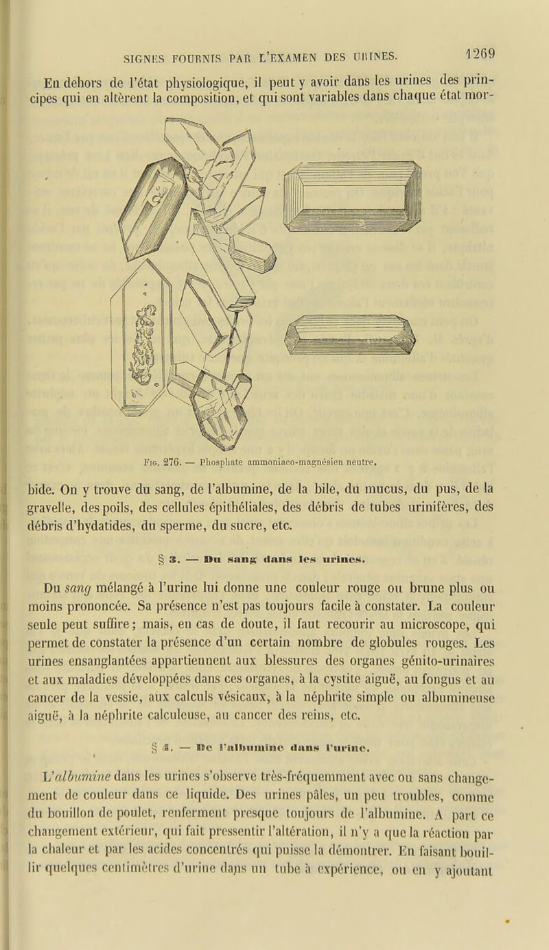 FiG. 276. — Phosphate ammoniaco-magnésien neutre. bide. On y trouve du sang, de l'albumine, de la bile, du mucus, du pus, de la gravelle, des poils, des cellules épithéliales, des débris de tubes urinifères, des débris d'hydatides, du sperme, du sucre, etc. § 3. — Du snng dans les urines. Du sang mélangé à l'urine lui donne une couleur rouge ou brune plus ou moins prononcée. Sa présence n'est pas toujours facile à constater. La couleur seule peut suffire; mais, en cas de doute, il faut recourir au microscope, qui permet de constater la présence d'un certain nombre de globules rouges. Les urines ensanglantées appartiennent aux blessures des organes génilo-urinaires et aux maladies développées dans ces organes, à la cystite aiguë, au fongus et au cancer de la vessie, aux calculs vésicaux, à la néphrite simple ou albumineuse aiguë, à la néphrite calculeuse, au cancer des reins, etc. § <S. — ne rnlhiiniinc ilanH rnrinc. L'albumine dans les urines s'observe très-fréquemment avec ou sans change- ment de couleur dans ce liquide. Des urines pâles, un peu troubles, comme du bouillon de poulet, renferment presque toujours de l'albumine. A pari ce changement extérieur, qui fait pressentir l'alléralion, il n'y a que la réaction par la chaleur et par les acides concentrés ([ui puisse la démontrer. En faisant bouil- lir quelques ccnlimèlrcs d'urine dajis un tube à expérience, ou en y ajoutant