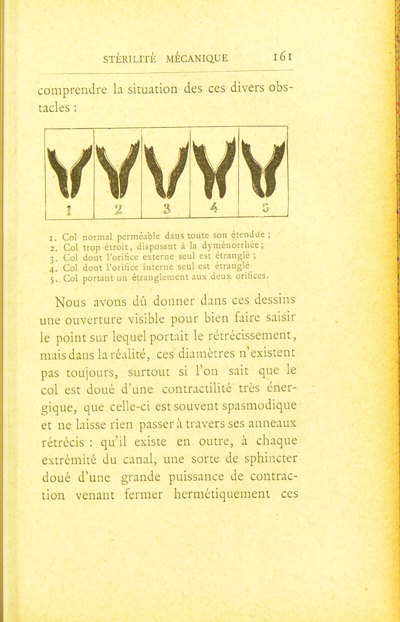comprendre la situation des ces divers obs- tacles : 1. Col normal perméable dans toute son étendue ; 2. Col trop étroit, disposant à la dyménorrhée; 3. Col dont l'orifice externe seul est étranglé ; 4. Col dont l'orifice interne seul est étranglé 5. Col portant un étranglement aux deux orifices. Nous avons dû donner dans ces dessins une ouverture visible pour bien faire saisir le point sur lequel portait le rétrécissement, mais dans la réalité, ces' diamètres n'existent pas toujours, surtout si l'on sait que le col est doué d'une contractilité très éner- gique, que celle-ci est souvent spasmodique et ne laisse rien passer à travers ses anneaux rétrécis : qu'il existe en outre, à chaque extrémité du canal, une sorte de sphincter doué d'une grande puissance de contrac- tion venant fermer hermétiquement ces