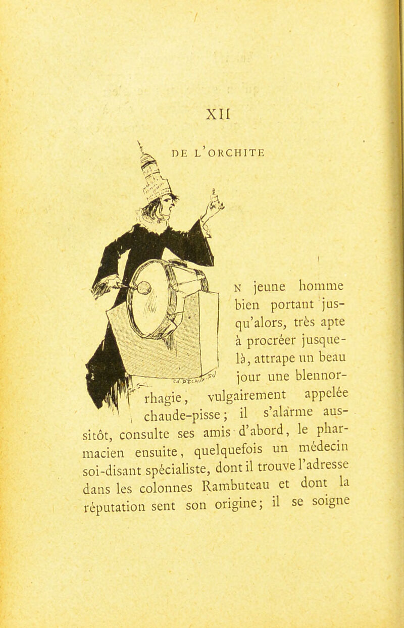 XII DE L ORCHITE N jeune homme bien portant jus- qu'alors, très apte à procréer jusque- là , attrape un beau jour une blennor- vulgairement appelée , chaude-pisse ; il s'alarme aus- sitôt, consulte ses amis d'abord, le phar- macien ensuite, quelquefois un médecin soi-disant spécialiste, dont il trouve l'adresse dans les colonnes Rambuteau et dont la réputation sent son origine; il se soigne