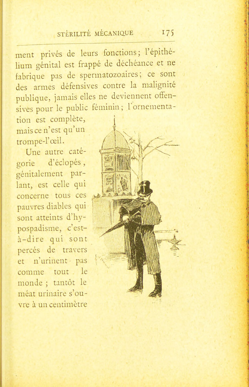 ment privés de leurs fonctions; l'épithé- lium génital est frappé de déchéance et ne fabrique pas de spermatozoaires ; ce sont des armes défensives contre la malignité publique, jamais elles ne deviennent offen- sives pour le public féminin ; Tornementa- 1 non est complète, mais ce n'est qu'un trompe-l'œil. Une autre caté- gorie d'éclopés , génitalement par- lant, est celle qui i^v.ç^f concerne tous ces pauvres diables qui sont atteints d'hy- pospadisme, c'est- à-dire qui sont percés de travers et n'urinent ■ pas comme tout le monde ; tantôt le méat urinaire s'ou- vre à un centimètre