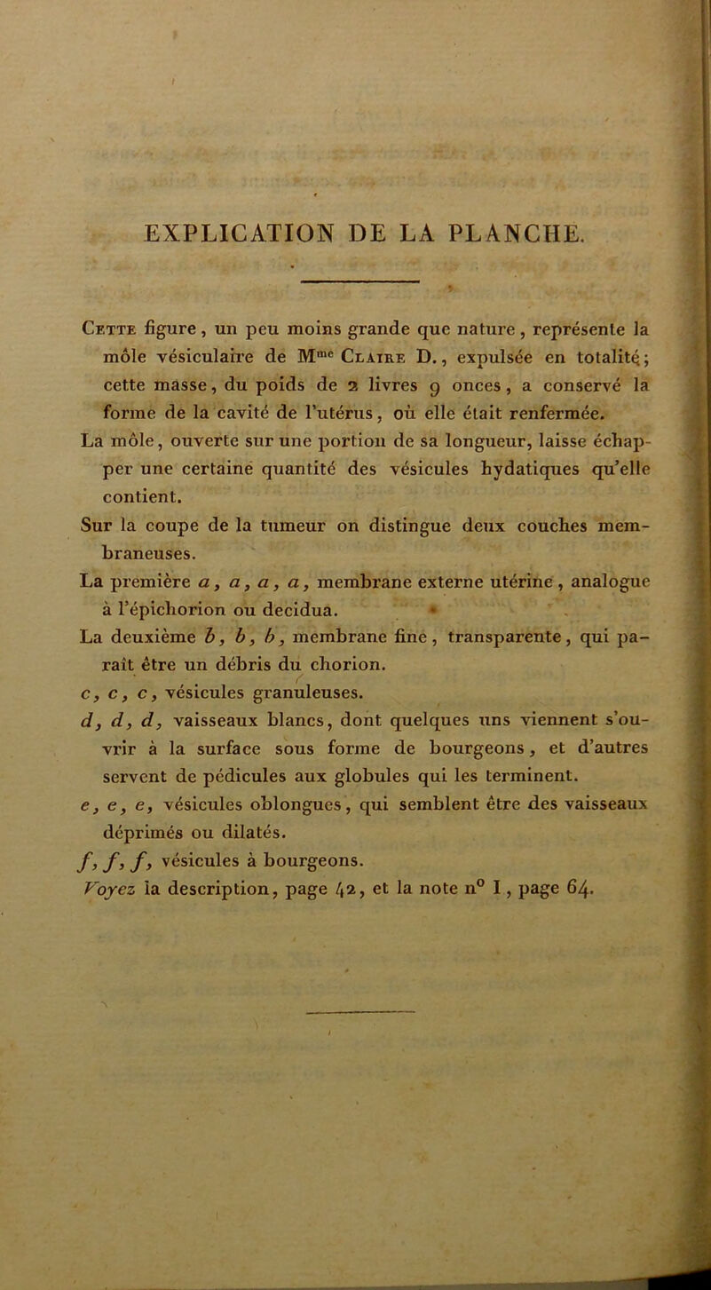 EXPLICATION DE LA PLANCHE. Cette figure , un peu moins grande que nature , représente la môle vésiculaire de M®® Ct aire D. , expulsée en totalité ; cette masse, du poids de 2 livres 9 onces, a conservé la forme de la cavité de Tutérus, où elle était renfermée. La môle, ouverte sur une portion de sa longueur, laisse échap- per une certaine quantité des vésicules hydatiques qu’elle contient. Sur la coupe de la tumeur on distingue deux couches mem- braneuses. La première a, a, a, a, membrane externe utérine , analogue à l’épichorion ou decidua. • La deuxième h, b, h, membrane fine , transparente, qui pa- raît être un débris du chorion. c, c, c, vésicules granuleuses. dj d, d, vaisseaux blancs, dont quelques uns viennent s’ou- vrir à la surface sous forme de bourgeons, et d’autres servent de pédicules aux globules qui les terminent. e, e, e, vésicules oblongues, qui semblent être des vaisseaux déprimés ou dilatés. f, f, f, vésicules à bourgeons. Voyez la description, page 42, et la note n° I, page 64.