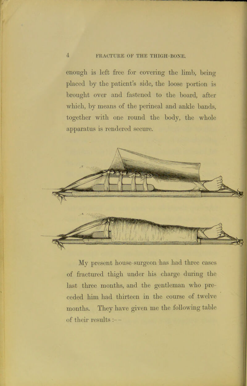 enough is left free for covering the limlj, being placed by the patient's side, the loose portion is brought over and fastened to the board, after which, by means of the perineal and ankle bands, together with one round the body, the whole apparatus is rendered secure. My present house-surgeon has had three cases of fractured thigh under his charge during the last three months, and the gentleman who pre- ceded him had thirteen in the com-se of twelve months. They have given me the following table of theii results :- -