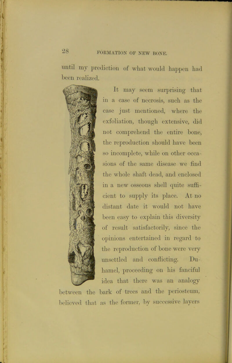 until my prediction of what wcjuld happen lia<l been realized. It may seem sui-prising that in a case of necrosis, such as the case just mentioned, where the exfoliation, though extensive, did not comprehend the entire bone, the reproduction should have been so incomplete, while on other occa- sions of the same disease we find the whole shaft dead, and enclosed in a new osseous shell quite suffi- cient to supply its place. At no distant date it would not have been easy to explain this diversity of result satisfactorily, since the opinions entertained in regard to the reproduction of bone were very unsettled and conflicting. Du- hamel, proceeding on his fanciful idea that there was an analogy between the bark of trees and the periosteum, believed that as the former, by successive layei-s liry.'