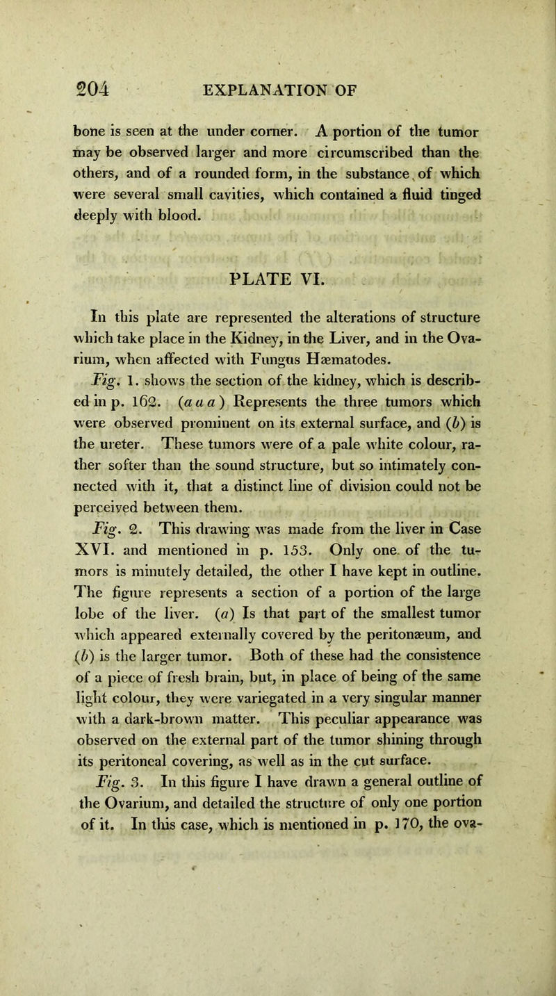 bone is seen at the under corner. A portion of the tumor may be observed larger and more circumscribed than the others, and of a rounded form, in the substance. of which were several small cavities, which contained a fluid tinged deeply with blood. PLATE VI. In this plate are represented the alterations of structure which take place in the Kidney, in the Liver, and in the Ova- rium, when affected with Fungus Haematodes. Fig. 1. shows the section of the kidney, which is describ- ed in p. 162. (a a a) Represents the three tumors which were observed prominent on its external surface, and (b) is the ureter. These tumors were of a pale white colour, ra- ther softer than the sound structure, but so intimately con- nected with it, that a distinct line of division could not be perceiyed between them. Fig. 2. This drawing was made from the liver in Case XVI. and mentioned in p. 153. Only one of the tu- mors is minutely detailed, the other I have kept in outline. The figure represents a section of a portion of the large lobe of the liver. («) Is that part of the smallest tumor which appeared externally covered by the peritonaeum, and (b) is the larger tumor. Both of these had the consistence of a piece of fresh brain, but, in place of being of the same light colour, they were variegated in a very singular manner with a dark-brown matter. This peculiar appearance was observed on the external part of the tumor shining through its peritoneal covering, as well as in the cut surface. Fig. 3. In this figure I have drawn a general outline of the Ovarium, and detailed the structure of only one portion of it. In tins case, which is mentioned in p. 170, the ova-
