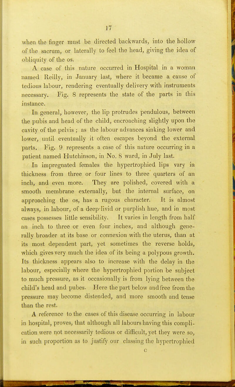 when the finger must be directed backwards, into the hollow of the sacrum, or laterally to feel the head, giving the idea of obliquity of the os. A case of this nature occurred in Hospital in a woman named Reilly, in January last, where it became a cause of tedious labour, rendering eventually delivery with instruments necessary. Fig. 8 represents the state of the parts in this instance. In general, however, the lip protrudes pendulous, between the pubis and head of the child, encroaching slightly upon the cavity of the pelvis ; as the labour advances sinking lower and lower, until eventually it often escapes beyond the external parts. Fig. 9 represents a case of this nature occurring in a patient named Hutchinson, in No. 8 ward, in July last. In impregnated females the hypertrophied lips vary in thickness from three or four lines to three quarters of an inch, and even more. They are polished, covered with a smooth membrane externally, but the internal surface, on approaching the os, has a rugous character. It is almost always, in labour, of a deep-livid or purplish hue, and in most cases possesses little sensibility. It varies in length from half an inch to three or even four inches, and although gene- rally broader at its base or connexion with the uterus, than at its most dependent part, yet sometimes the reverse holds, which gives very much the idea of its being a polypous growth. Its thickness appears also to increase with the delay in the labour, especially where the hypertrophied portion be subject to much pressure, as it occasionally is from lying between the child's head and pubes. Here the part below and free from the pressure may become distended, and more smooth and tense than the rest. A reference to the cases of this disease occurring in labour in hospital, proves, that although all labours having this compli- cation were not necessarily tedious or difficult, yet they were so, in such proportion as to justify our classing the hypertrophied c