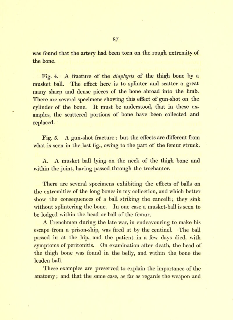 was found that the artery had been torn on the rough extremity of the bone. Fig. 4. A fracture of the diaphysis of the thigh bone by a musket ball. The effect here is to splinter and scatter a great many sharp and dense pieces of the bone abroad into the limb. There are several specimens showing this effect of gun-shot on the cylinder of the bone. It must be understood, that in these ex- amples, the scattered portions of bone have been collected and replaced. Fig. 5. A gun-shot fracture; but the effects are different from what is seen in the last fig., owing to the part of the femur struck. A. A musket ball lying on the neck of the thigh bone and within the joint, having passed through the trochanter. There are several specimens exhibiting the effects of balls on the extremities of the long bones in my collection, and which better show the consequences of a ball striking the cancelli; they sink without splintering the bone. In one case a musket-ball is seen to be lodged within the head or ball of the femur. A Frenchman during the late war, in endeavouring to make his escape from a prison-ship, was fired at by the centinel. The ball passed in at the hip, and the patient in a few days died, with symptoms of peritonitis. On examination after death, the head of the thigh bone was found in the belly, and within the bone the leaden ball. These examples are preserved to explain the importance of the anatomy ; and that the same case, as far as regards the weapon and