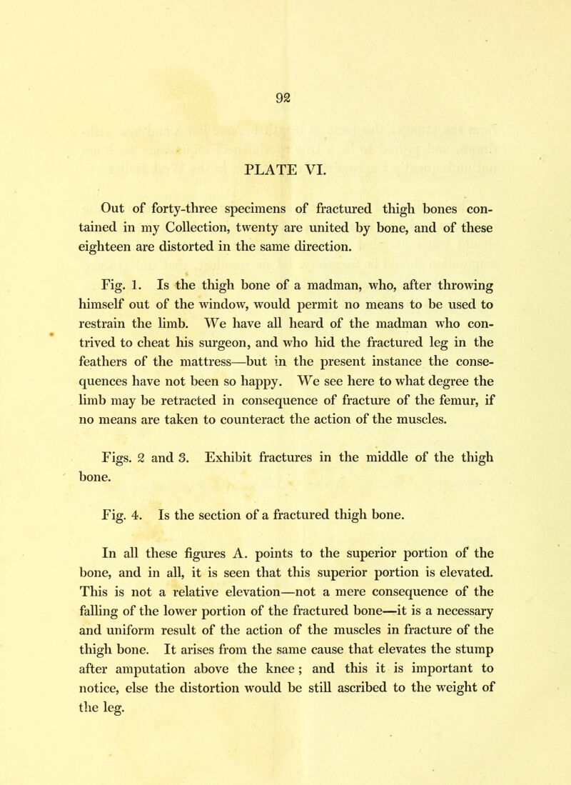 PLATE VI. Out of forty-three specimens of fractured thigh bones con- tained in my Collection, twenty are united by bone, and of these eighteen are distorted in the same direction. Fig. 1. Is the thigh bone of a madman, who, after throwing himself out of the window, would permit no means to be used to restrain the limb. We have all heard of the madman who con- trived to cheat his surgeon, and who hid the fractured leg in the feathers of the mattress—but in the present instance the conse- quences have not been so happy. We see here to what degree the limb may be retracted in consequence of fracture of the femur, if no means are taken to counteract the action of the muscles. Figs. 2 and 3. Exhibit fractures in the middle of the thigh bone. Fig. 4. Is the section of a fractured thigh bone. In all these figures A. points to the superior portion of the bone, and in all, it is seen that this superior portion is elevated. This is not a relative elevation—not a mere consequence of the falling of the lower portion of the fractured bone—it is a necessary and uniform result of the action of the muscles in fracture of the thigh bone. It arises from the same cause that elevates the stump after amputation above the knee; and this it is important to notice, else the distortion would be still ascribed to the weight of the leg.