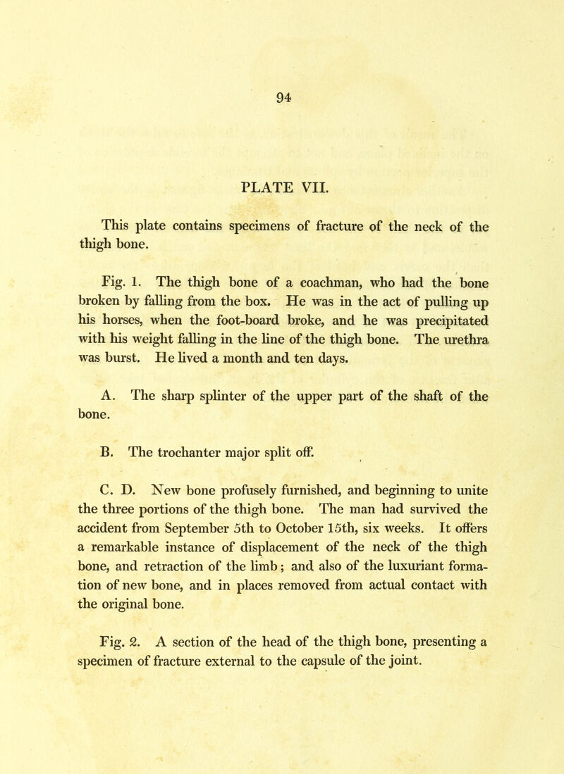 PLATE VII. This plate contains specimens of fracture of the neck of the thigh bone. Fig. 1. The thigh bone of a coachman, who had the bone broken by falling from the box. He was in the act of pulling up his horses, when the foot-board broke, and he was precipitated with his weight falling in the line of the thigh bone. The urethra was burst. He lived a month and ten days. A. The sharp splinter of the upper part of the shaft of the bone. B. The trochanter major split off. C. D. New bone profusely furnished, and beginning to unite the three portions of the thigh bone. The man had survived the accident from September 5th to October 15th, six weeks. It offers a remarkable instance of displacement of the neck of the thigh bone, and retraction of the limb; and also of the luxuriant forma- tion of new bone, and in places removed from actual contact with the original bone. Fig. 2. A section of the head of the thigh bone, presenting a specimen of fracture external to the capsule of the joint.