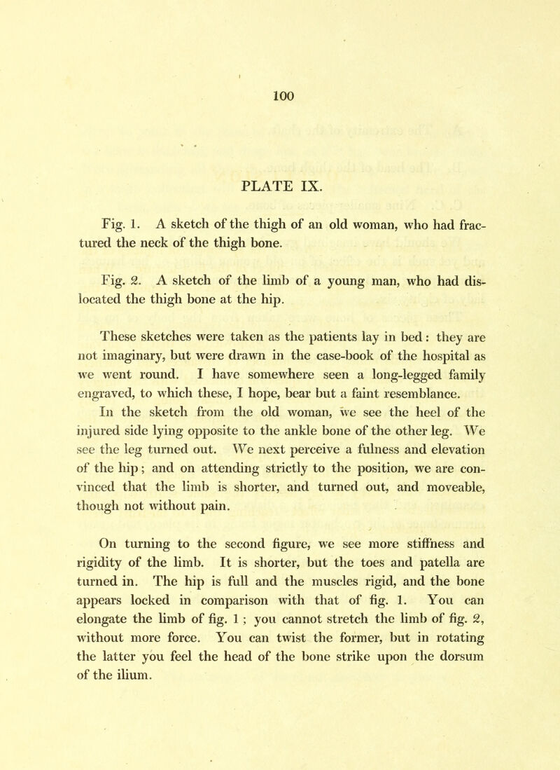 PLATE IX. Fig. 1. A sketch of the thigh of an old woman, who had frac- tured the neck of the thigh bone. Fig. 2. A sketch of the limb of a young man, who had dis- located the thigh bone at the hip. These sketches were taken as the patients lay in bed: they are not imaginary, but were drawn in the case-book of the hospital as we went round. I have somewhere seen a long-legged family engraved, to which these, I hope, bear but a faint resemblance. In the sketch from the old woman, we see the heel of the injured side lying opposite to the ankle bone of the other leg. We see the leg turned out. We next perceive a fulness and elevation of the hip; and on attending strictly to the position, we are con- vinced that the limb is shorter, and turned out, and moveable, though not without pain. On turning to the second figure, we see more stiffness and rigidity of the limb. It is shorter, but the toes and patella are turned in. The hip is full and the muscles rigid, and the bone appears locked in comparison with that of fig. 1. You can elongate the limb of fig. 1 ; you cannot stretch the limb of fig. 2, without more force. You can twist the former, but in rotating the latter you feel the head of the bone strike upon the dorsum of the ilium.
