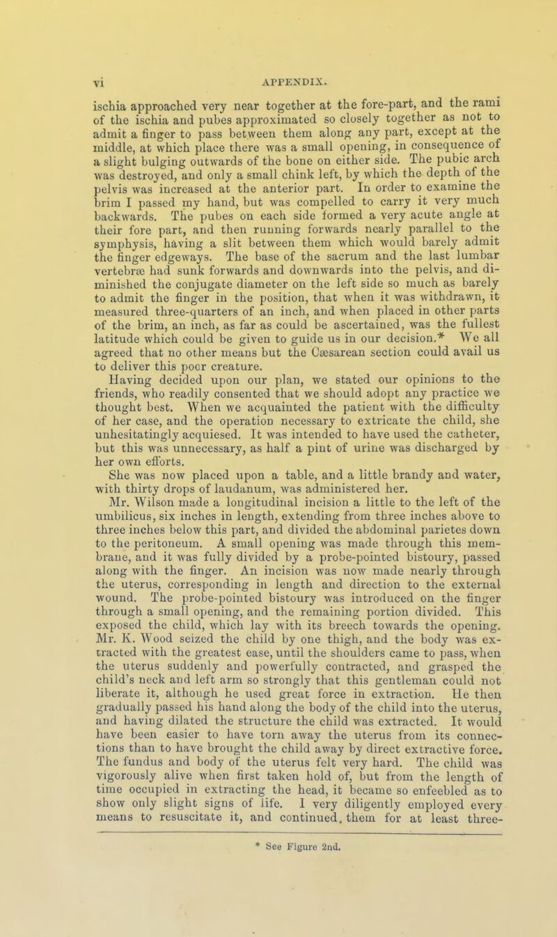 ischia approached very near together at the fore-part, and the rami of the ischia and pubes approximated so closely together as not to admit a finger to pass between them along any part, except at the iniddle, at which place there was a small opeaing, in consequence of a slight bulging outwards of the bone on either side. The pubic arch was destroyed, and only a small chink left, by which the depth of the pelvis was increased at the anterior part. In order to examine the brim I passed my band, but was compelled to carry it very much backwards. The pubes on each side formed a very acute angle at their fore part, and then ruuning forwards ncarly parallel to the Symphysis, having a slit between them which would barely admit the finger edgeways. The base of the sacrum and the last lumbar vertebrEc had sunk forwards and downwards into the pelvis, and di- minished the conjugate diameter on the left side so much as barely to admit the finger in the position, that when it was withdrawn, it measured three-quarters of an inch, and when placed in other parts of the brim, an inch, as far as could be ascertained, was the füllest latitude which could be given to guide us in our decision.* We all agreed that no other means but the Cassarean section could avail us to deliver this poor creature. Having decided upon our plan, we stated our opinions to the friends, who readily consented that we should adopt any practice we thought best. When we acquainted the patient with the difficulty of her case, and the Operation necessary to extricate the child, she unhesitatingly acquiesed. It was intended to have used the catheter, but this was unnecessary, as half a pint of urine was discharged by her own eflforts. She was now placed upon a table, and a little brandy and water, with thirty drops of laudanum, was administered her. Mr. Wilson made a longitudinal incision a little to the left of the umbilicus, six inches in length, extending from three inches above to three inches below this part, and divided the abdominal parietes down to the Peritoneum. A small opening was made through this mem- brane, and it was fully divided by a probe-pointed bistoury, passed along with the finger. An incision was now made nearly through the Uterus, correspondiug in length and direction to the external wound. The probe-pointed bistoury was introduced on the finger through a small opening, and the remaining portion divided. This exposed the child, which lay with its breech towards the opening. Mr. K. Wood seized the child by one thigh, and the body was ex- tracted with the greatest ease, until the Shoulders came to pass, when the Uterus suddenly and powerfully contracted, and grasped the child's neck aud left arm so strongly that this gentlemau could not liberale it, although he used great force in extraction. Ile then gradually passed his band along the body of the child into the Uterus, and having dilated the structure the child was extracted. It would have been easier to have torn away the uterus from its connec- tions than to have brought the child away by direct extractive force. The fundus and body of the uterus feit very hard. The child was vigorously alive when first taken hold of, but from the length of time occupied in extracting the head, it became so enfeebled as to show only slight signs of life. 1 very diligently employed every means to resuscitate it, and continued. them for at least three-