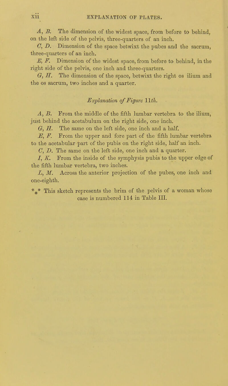 A, B. The dimension of the widest space, from before to behind, on the left side of the pelvis, three-quarters of an inch. C, D. Dimension of the space betwixt the pubes and the sacrum, three-qxxarters of an inch. E, F. Dimension of the widest space, from before to behind, in the right side of the pelvis, one inch and three-quarters. G, H. The dimension of the space, betwixt the right os ilium and the os sacrum, two inches and a quarter. Explanation of Figure 11th. A, B. From the middle of the fifth lumbar vertebra to the ilium, just behind the acetabulum on the right side, one inch. G, H. The same on the left side, one inch and a half. JE, F. From the upper and fore part of the fifth lumbar vertebra to the acetabular part of the pubis on the right side, half an inch. C, D. The same on the left side, one inch and a quarter. I, K. From the inside of the symphysis pubis to the upper edge of the fifth lumbar vertebra, two inches. L, M. Across the anterior projection of the pubes, one inch and one-eighth. *#* This sketch represents the brim of the pelvis of a woman whose case is numbered 114 in Table III.