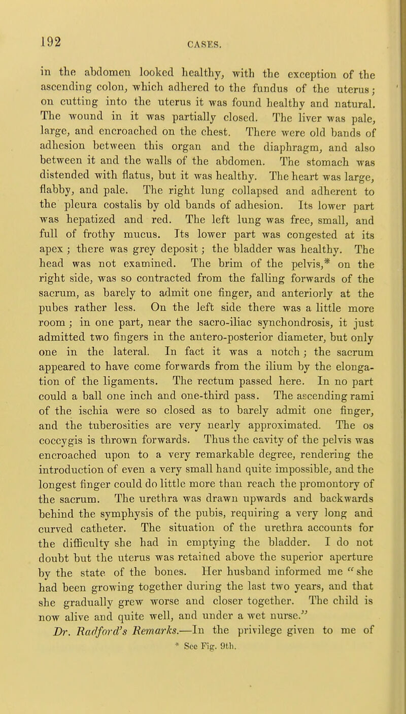 in the abdomen looked healthy, with the exception of the ascending colon, which adhered to the fundus of the uterus j on cutting into the uterus it was found healthy and natural. The wound in it was partially closed. The liver was pale, large, and encroached on the chest. There were old bands of adhesion between this organ and the diaphragm, and also between it and the walls of the abdomen. The stomach was distended with flatus, but it was healthy. The heart was large, flabby, and pale. The right lung collapsed and adherent to the pleura costalis by old bands of adhesion. Its lower part was hepatized and red. The left lung was free, small, and full of frothy mucus. Its lower part was congested at its apex ; there was grey deposit; the bladder was healthy. The head was not examined. The brim of the pelvis,* on the right side, was so contracted from the falling forwards of the sacrum, as barely to admit one finger, and anteriorly at the pubes rather less. On the left side there was a little more room ; in one part, near the sacro-iliac synchondrosis, it just admitted two fingers in the antero-posterior diameter, but only one in the lateral. In fact it was a notch; the sacrum appeared to have come forwards from the ilium by the elonga- tion of the ligaments. The rectum passed here. In no part could a ball one inch and one-third pass. The ascending rami of the ischia were so closed as to barely admit one finger, and the tuberosities are very nearly approximated. The os coccygis is thrown forwards. Thus the cavity of the pelvis was encroached upon to a very remarkable degree, rendering the introduction of even a very small hand quite impossible, and the longest finger could do little more than reach the promontory of the sacrum. The urethra was drawn upwards and backwards behind the symphysis of the pubis, requiring a very long and curved catheter. The situation of the urethra accounts for the difficulty she had in emptying the bladder. I do not doubt but the uterus was retained above the superior aperture by the state of the bones. Her husband informed me  she had been growing together during the last two years, and that she gradually grew worse and closer together. The child is now alive and quite well, and under a wet nurse. Dr. Radford's Remarks.—In the privilege given to me of * See Fig. 9th.