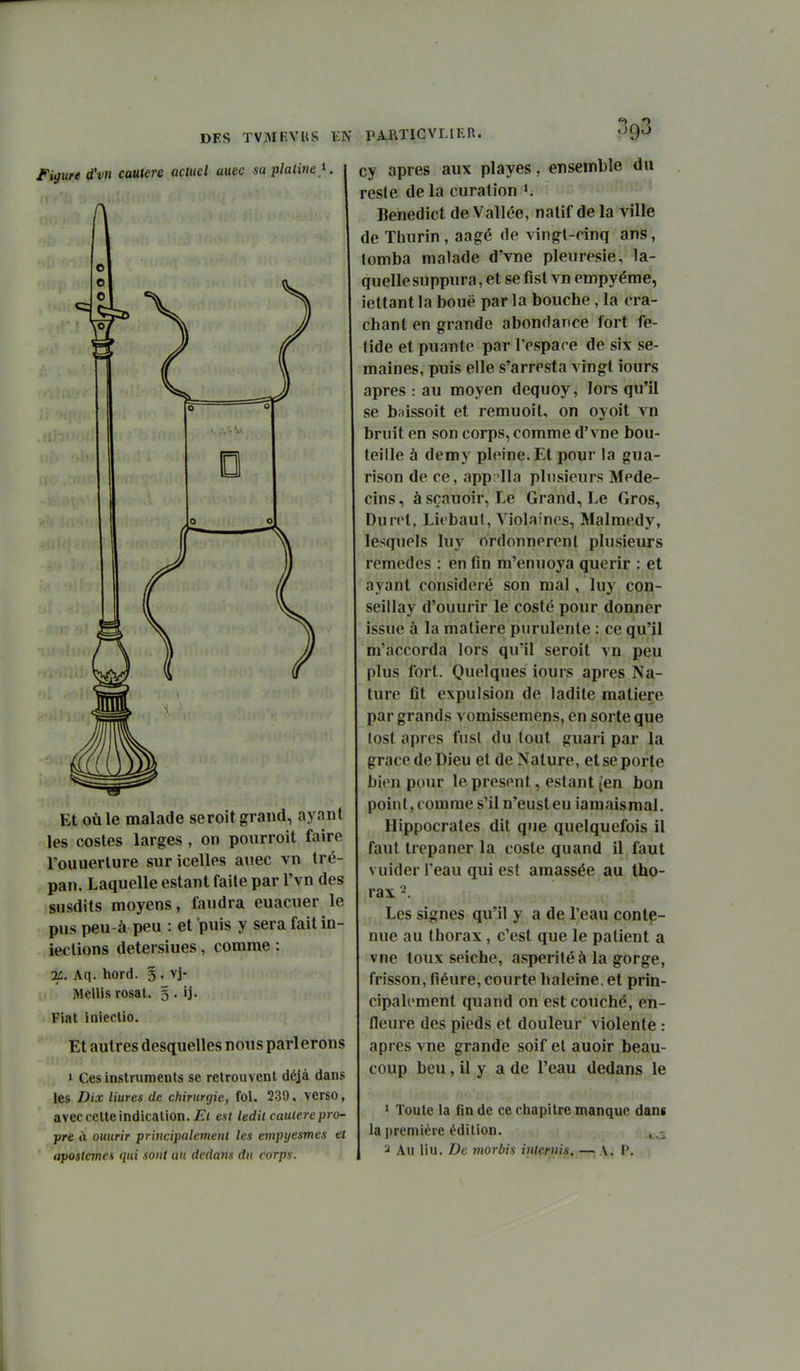 DES TVMF.VUS Figure d'vn cautère actuel auec sa platine_K PARTICVLIKR. 093 Et où le malade seroit grand, ayant les costes larges , on pourroit faire l'ouuerlure sur icelles auec vn tré- pan. Laquelle estant faile par l'vn des susdits moyens, faudra euacuer le pus peu-à peu : et puis y sera faitin- ieclions detersiues, comme : 2C, Aq. hord. §. vj- Mcllis rosat. 3 . ij. Fiat Inîectio. Et autres desquelles nous parlerons » Ces instruments se retrouvent déjà dans les Dix Hures de chirurgie, fol. 239. verso, avec cette indication. £■< est ledit cautère pro^ pre à ouurir principalement les emptjesmes et apostemes qui sont au dedans du corps. ensemble du cy après aux playes resle de la curalion K Benedict de Vallée, natif de la ville de Thurin , aagé de vingl-rînq ans, tomba malade d'vne pleurésie, la- quelle suppura, et sefisl vn empyéme, iettant la bouë par la bouche, la cra- chant en grande abondance fort fé- tide et puante par l'espace de six se- maines, puis elle s'arresta vingt iours après : au moyen dequoy, lors qu'il se baissoit et remuoit, on oyoit vn bruit en son corps, comme d'vne bou- teille à demy pleine. Et pour la gua- rison de ce, app ila plusieurs Méde- cins, àsçauoir, Le Grand, Le Gros, Durct, Licbaut, Violaines, Malmedy, lesquels luy ordonnèrent plusieurs remèdes : en fin m'enuoya quérir : et ayant considéré son mal, luy con- seil lay d'ouurir le costé pour donner issue à la matière purulente : ce qu'il m'accorda lors qu'il seroit vn peu plus fort. Quelques iours après Na- ture fit expulsion de ladite matière par grands vomîssemens, en sorte que losl après fnsl du tout guari par la grâce de Dieu et de Nature, et se porte bien pour le présent, estant (en bon point, comme s'il n'eusteu iamaismal. Hippocrates dit que quelquefois il faut trépaner la coste quand il faut vuider l'eau qui est amassée au tho- rax 2. Les signes qu'il y a de l'eau conte- nue au thorax , c'est que le patient a vue toux seiche, aspérité à la gorge, frisson, fiéure, courte haleine, et prin- cipalement quand on est couché, en- fleure des pieds et douleur violente : après vue grande soif et auoir beau- coup beu, il y a de l'eau dedans le ^ Toute la fin de ce chapitre manque dans la première édition. ,^ 2 Au liu. De morbis interuis. — A. P.