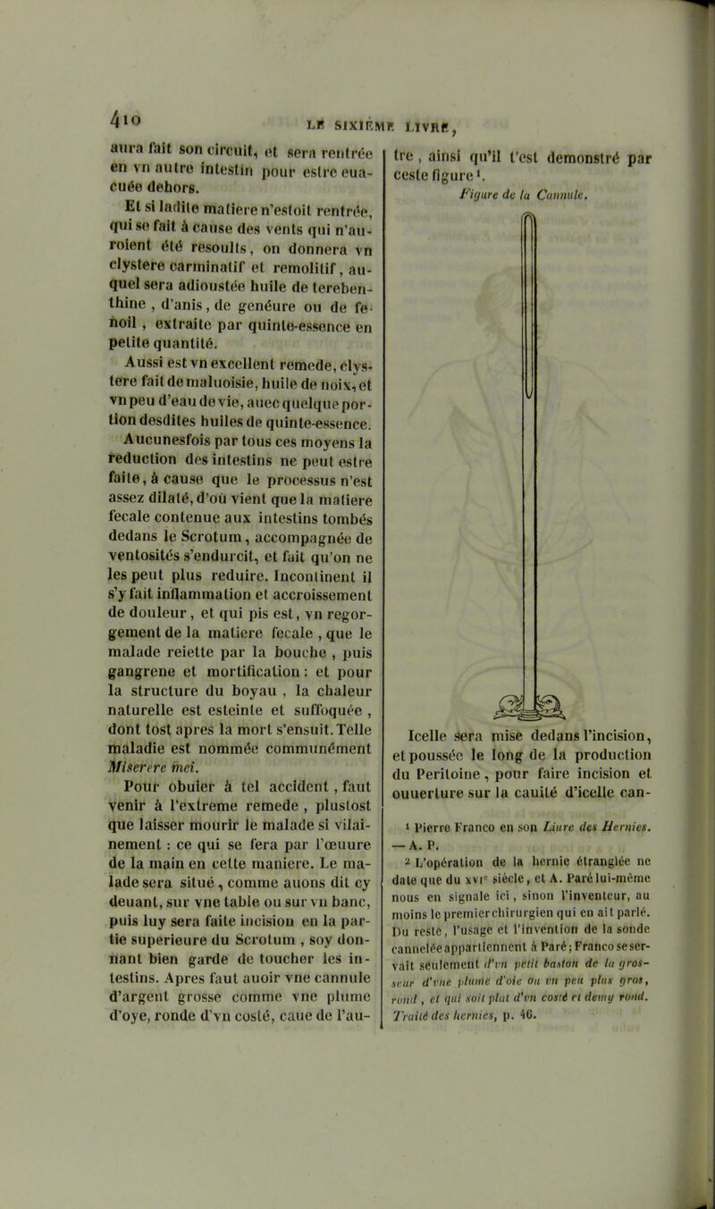 4ïO LË SIXIR aura l'ait son circuit, ot sera rentrée en vil autre intestin pour estrc eua- cuée dehors. El si ladite matière n'estoit rentrée, qui go fait à cause des vents qui n'au- rolent été resouHs, on donnera yn clystere carrninatif et lemolitif, au- quel sera adioustée huile de térében- thine , d'anis, de g-enéure ou de fe- iïoil, extraite par quinte-essence en petite quantité. Aussi est vn excellent remède, clys- lete fait de maluoisie, huile de noix, et vn peu d'eau de vie, aiiec quelque por - lion desdites huiles de quinte-essence. Aucunesfois par tous ces moyens la réduction des intestins ne peut estre faite, à cause que le processus n'est assez dilaté, d'où vient que la matière fecale contenue aux intestins tombés dedans le Scrotum, accompagnée de ventosités s'endurcit, et fuit qu'on ne les peut plus réduire. Incontinent il s'y fait inflammation et accroissement de douleur, et qui pis est, vn regor- gement de la matière fecale , que le malade reiette par la bouche , puis gangrené et mortificalion : et pour la structure du boyau , la chaleur naturelle est esteinte et suffoquée , dont tost après la mort s'ensuit. Telle maladie est nommée communément Miserere mei. Pour obuier à tel accident, faut venir à l'extrême remède , pluslost que laisser mourir le malade si vilai- nement : ce qui se fera par l'œuure de la main en celte manière. Le ma- lade sera situé, comme auons dit cy deuant, sur vue table ou sur vn banc, puis luy sera faite incisiou en la par- tie supérieure du Scrotum , soy don- nant bien garde de toucher les in- testins. Apres faut auoir vue cannule d'argent grosse comme vue plume d'oye, ronde d'vn coslé, caue de l'au- Mlï LÏVRB, tre , ainsi qu'il t'est demonslré par ceste figure'. Figure de la Cannule. Icelle sera mise dedans l'incision, et poussée le long de la production du Péritoine, pour faire incision et ouuerture sur la cauité d'icelle can- 1 Pierre Franco en son Liure des Hernies. — A. P. L'opération de la hernie étranglée ne date que du xvr siècle, et A. Paré lui-même nous en signale ici, sinon l'invenleur, au moins Icpremiercliirurgien qui en ait parlé. Du reste, l'usage cl l'invention de la sonde canneiéeapparliennent à Paré; Franco se ser- vait seulement d'vn petit banion de la gros- saur d'vite plume d'oie ou vn peu plus gros, rond , et qui soil plat d'vn cosii ei dewy rond. Traité des hernies, p. 46.