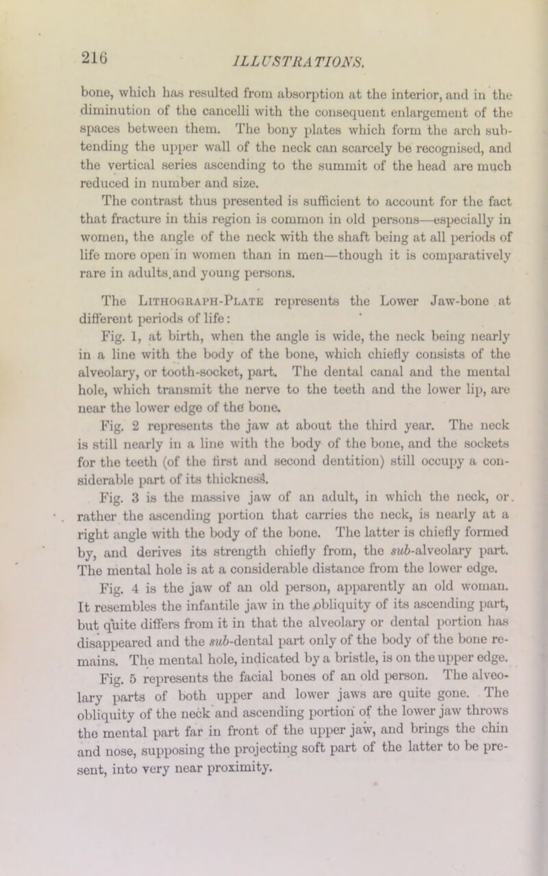 bone, which ban resulted from absorption at the interior, and in the diminution of the cancelli with the consequent enlargement of the spaces between them. The bony plates which form the arch sub- tending the upper wall of the neck can scarcely be recognised, and the vertical series ascending to the summit of the head are much reduced in number and size. The contrast thus presented is sufficient to account for the fact that fracture in this region is common in old persons—especially in women, the angle of the neck with the shaft being at all periods of life more open in women than in men—though it is comparatively rare in adults, and young persons. The Lithograph-Plate represents the Lower Jaw-bone at different periods of life: Fig. 1, at birth, when the angle is wide, the neck being nearly in a line with the body of the bone, which chiefly consists of the alveolary, or tooth-socket, part. The dental canal and the mental hole, which transmit the nerve to the teeth and the lower lip, are near the lower edge of the bone. Fig. 2 represents the jaw at about the third year. The neck is still nearly in a line with the body of the bone, and the sockets for the teeth (of the flrst and second dentition) still occupy a con- siderable part of its thicknesB. Fig. 3 is the massive jaw of an adult, in which the neck, or. rather the ascending portion that carries the neck, is nearly at a right angle with the body of the bone. The latter is chiefly formed by, and derives its strength chiefly from, the sw&-alveolary part. The mental hole is at a considerable distance from the lower edge. Fig. 4 is the jaw of an old person, apparently an old woman. It resembles the infantile jaw in the obliquity of its ascending part, but quite differs from it in that the alveolary or dental portion has disappeared and the sw&-dental part only of the body of the bone re- mains. The mental hole, indicated by a bristle, is on the upper edge. Fig. 5 represents the facial bones of an old person. The alveo- lary parts of both upper and lower jaws are quite gone. The obliquity of the neck and ascending portion of the lower jaw throws the mental part far in front of the upper jaw, and brings the chin and nose, supposing the projecting soft part of the latter to be pre- sent, into very near proximity.