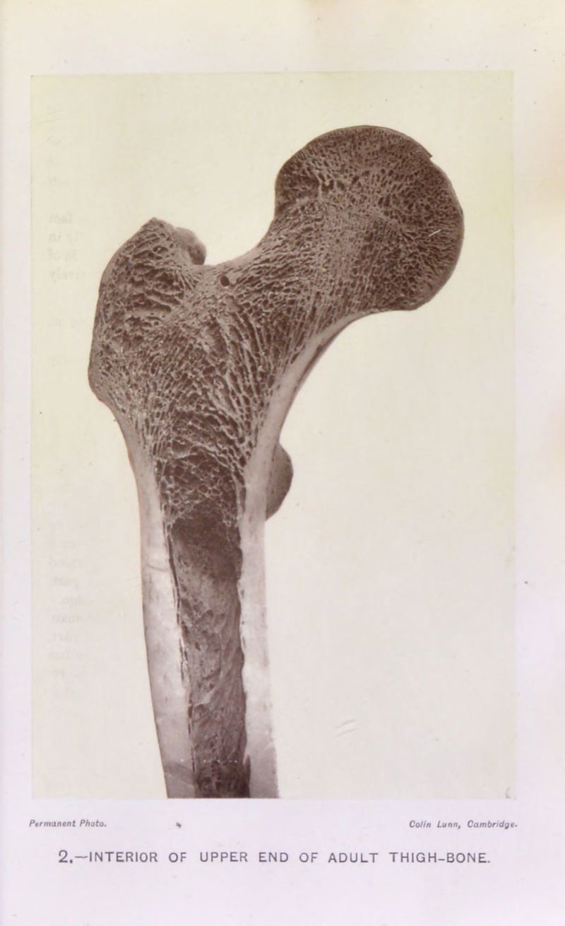 2.—INTERIOR OF UPPER END OF ADULT THIGH-BONE.