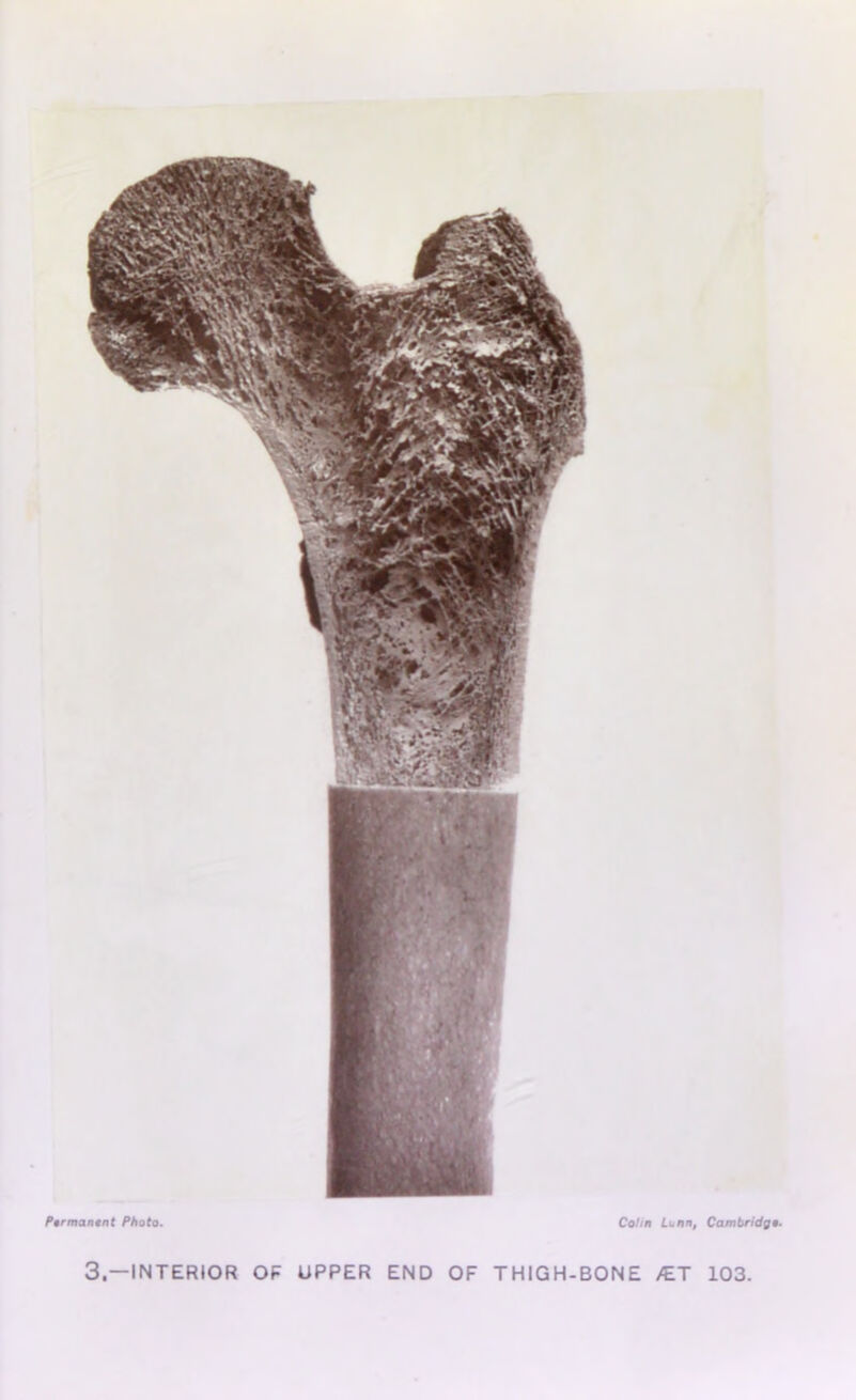 Pormanont Photo. Cohn Lunn, Cambridge 3.—INTERIOR OF UPPER END OF THIGH-BONE /ET 103.