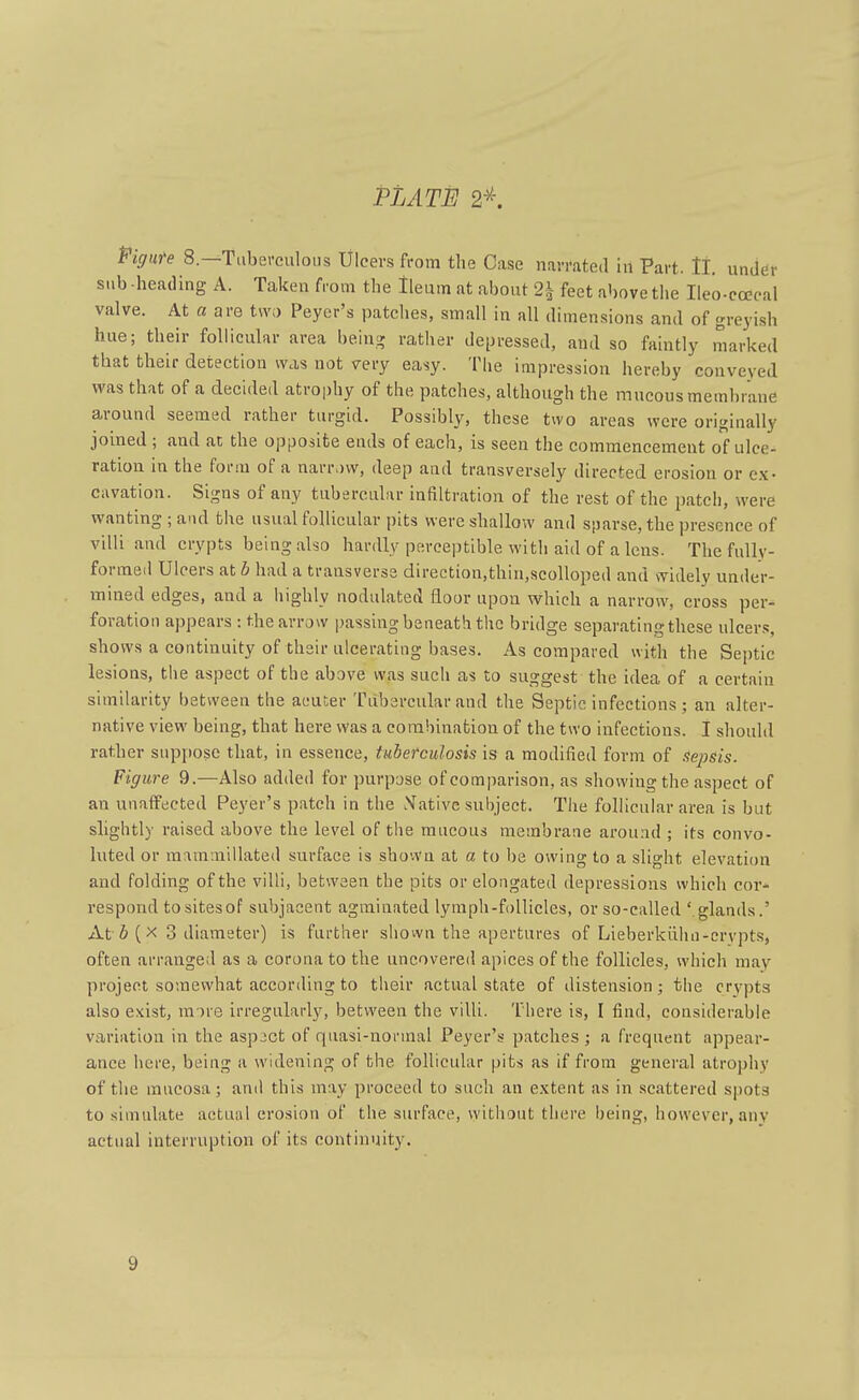 Figute 8.—Tuberculous Ulcers from the Case narrated in Part. ll. under sub -heading A. Taken from the Ileum at about 2^ feet above the Ileo-coecal valve. At a are two Peyer's patches, small in all dimensions and of greyish hue; their follicular area being rather depressed, and so faintly marked that their detection was not very easy. The impression hereby conveyed was that of a decided atrophy of the patches, although the mucous membrane around seemed rather turgid. Possibly, these two areas were originally joined ; and an the opposite ends of each, is seen the commencement of ulce- ration in the foi-m of a narr.)w, deep and transversely directed erosion or ex- cavation. Signs of any tubercular iaaitration of the rest of the patch, were wanting ; and the usual follicular pits were shallow and sparse, the presence of villi and crypts being also hardly perceptible with aid of a lens. The fully- formed Ulcers at b had a transverse direction,thin,scolloped and widely under- mined edges, and a liighly nodulated floor upon which a narrow, cross per-i foration appears : the arrow passing beneath the bridge separating these ulcers, shows a continuity of their ulcerating bases. As compared with the Septic lesions, the aspect of the above was such as to suggest the idea of a certain similarity between the aeuter Tubercular and the Septic infections; an alter- native view being, that here was a corabinafcion of the two infections. 1 should rather suppose that, in essence, tuberculosis is a modified form of Sejisis. Figure 9.—Also added for purpose of comparison, as showing the aspect of an unaffected Peyer's patch in the Native subject. The follicular area is but slightly raised above the level of the mucous membrane around ; its convo- luted or mammillated surface is shown at a to be owing to a slight elevation and folding of the villi, between the pits or elongated depressions which cor^ respond tositesof subjacent agminated lymph-follicles, or so-called ' glands.' At 6 (X 3 diameter) is farther shown the apertures of Lieberkiilui-crvpts, often arranged as a corona to the uncovered apices of the follicles, which may project somewhat according to their actual state of distension; the crypts also exist, more irregularly, between the villi. There is, I find, considerable variation in the asp2ct of quasi-normal Peyer's patches ; a frequent appear- ance here, being a widening of the follicular pits as if from general atrophy of the mucosa; and this may proceed to such an extent as in scattered spots to simulate actual erosion of the surface, without there being, however, any actual interruption of its continuity. 9