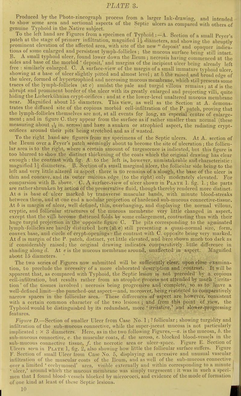 Produced by the Photo-zincograpli process from a larger Ink-drawing, and intended to show some area and sectional aspects of the Septic ulcers as compared with others of genuine Typhoid in the Native subject. To the left hand are Figures from a specimen of Typhoid :—A. Section of a small Peyer's patch at the stage of primary infiltration, magnified i| diameters, and showing the abruptly promment elevation of the affected area, with site of the new  deposit' and opaquer indica- tions of some enlarged and persistent lymph-follicles ; the mucous surface being still intact. B. A small typhoid ulcer, found lower down the Ileum; necrosis having commenced at the sides and base of the morbid ' deposit,' and margins of the incipient ulcer being already left free : similarly enlarged. 0. A surface-view of the margin of a small immature typhoid ulcer, showing at a base of ulcer slightly pitted and almost level; at b the raised and broad edge of the ulcer, formed of hypertrophied and necrosing mucous membrane, which still presents some traces of the lymph-follicles (at c) amidst the pale and turgid villous remains; at d is the abrupt and prominent border of the ulcer with its greatly enlarged and projecting villi, quite hiding the Lieberkiihrnan crypt-orifices : and at e the lower-level unaltered mucous membrane near. Magnified about 15 diameters. This view, as well as the Section at A. demons- trates the diffused site of the copious morbid cell-infiltration of the P. patch, proving that the lymph-follicles themselves are not, at all events for long, an especial centre of enlarge- ment ; and in figure C. they appear from the surface as if rather smaller than normal (these measuring about -gV in- across) and have a sunken or atrophied aspect, the radiating crypt- orifices around their pits being stretched and as if wasted. To the right hand are figures from my specimens of the Septic ulcers. At A. section of the Ileum over a Peyer's patch seemingly about to become the site of ulceration; the follicu- lar area is to the right, where a certain amount of turgescence is indicated, but this figure is too blurred to show the distinct thickening of the coats which the original drawing has clear enough : the contrast with fig. A. to the left is, however, nnmistakeable and characteristic: magnified 1^ diameters. B. Section of a small marginal ulcer, the follicidar side being to the left and very little altered in aspect: there is no remains of a slough, the base of the ulcer is thin and concave, and its outer mucous edge (to the right) only moderately elevated. For comparsion with B. above. C. A surface-view of ulcer shown in Plate 1. fig. 1.; the parts are rather shrunken by action of the preservative fluid, though thereby rendered more distinct. At a is base of ulcer marked by transverse muscular bands, with minute blood-streaks between them, and at one end a nodular projection of hardened sub-mucous connective-tissue. At b is margin of ulcer, well defined, thin, overhanging, and displaying the normal villous, cryptic, and follicular structui-es of the raucous membrane very little changed in aspect, except that the villi become flattened folds by some enlargement, contrasting thus with their huge turgid projection in the opposite figure C. The pits corresponding to the agminated lymph-follicles are hardly disturbed here (at c) still presenting a quasi-normal size, form, convex base, and circle of crypt-openings : the contrast with C. opposite being very marked. At d IS margin of the P. patch, distinct, yet little elevated, and here shown much too dark as if considerably raised; the original drawing indicates comparatively little difference in shading along d. At e is the mucous membrane araund, unaffected in aspect. Magnified about 15 diameters. The two series of Figures now submitted will be sufficiently clear, upon close examina- tion, to preclude the necessity of a more elaborated description and contrast. It will be apparent that, as compared with Typhoid, the Septic lesion is not preceded by a copious cell-infiltration, but results rather from an atrophic process not attended by much ! irrita- tion ' of the tissues involved : necrosis being progressive and complete, so as to leave a well-defined limit—the punched-out aspect—and, moreover, being restricted to comparatively narrow spaces in the follicular area. These differences of aspect are however, consistent with a certain common character of the two lesions ; and from this point of view, the Typhoid would be distinguished by its redundant, more ' irritative,' and slower-progressing features. ; -. Figure D.—Section of smaller Ulcer from Case No- 1; ? follicular; showing turgidity and infiltration of the sub-mucous connective, while the super-jaceut mucosa is not particularly implicated : x 3 diameters. Here, as in the two following Figures,—a. is the mucosa, the sub-mucous connective, c the muscular coats, d. the serosa, e. blocked blood-vessels in the sub-raucous connective tissue, /. the necrotic area or ulcer-space. Figure E. Section of Ulcers seen in Plate 1, fig. 2, also showing how little the follicular surface suffers. Figure F. Section of small Ulcer from Case No. 5, displaying an excessive and unusual vascular infiltration of the muscular coats of the Ileum, and as well of the sub-mucous connective over a limited ' ecchymosed' area, visiide externally and within corresponding to a minute ' ulcer,' around whicii the mucous membrane was simply turgescent : it was in such a speci- men that I found blood-vessels blocked by micrococci, and evidence of the mode of formation of one kind at least of these Septic lesions.