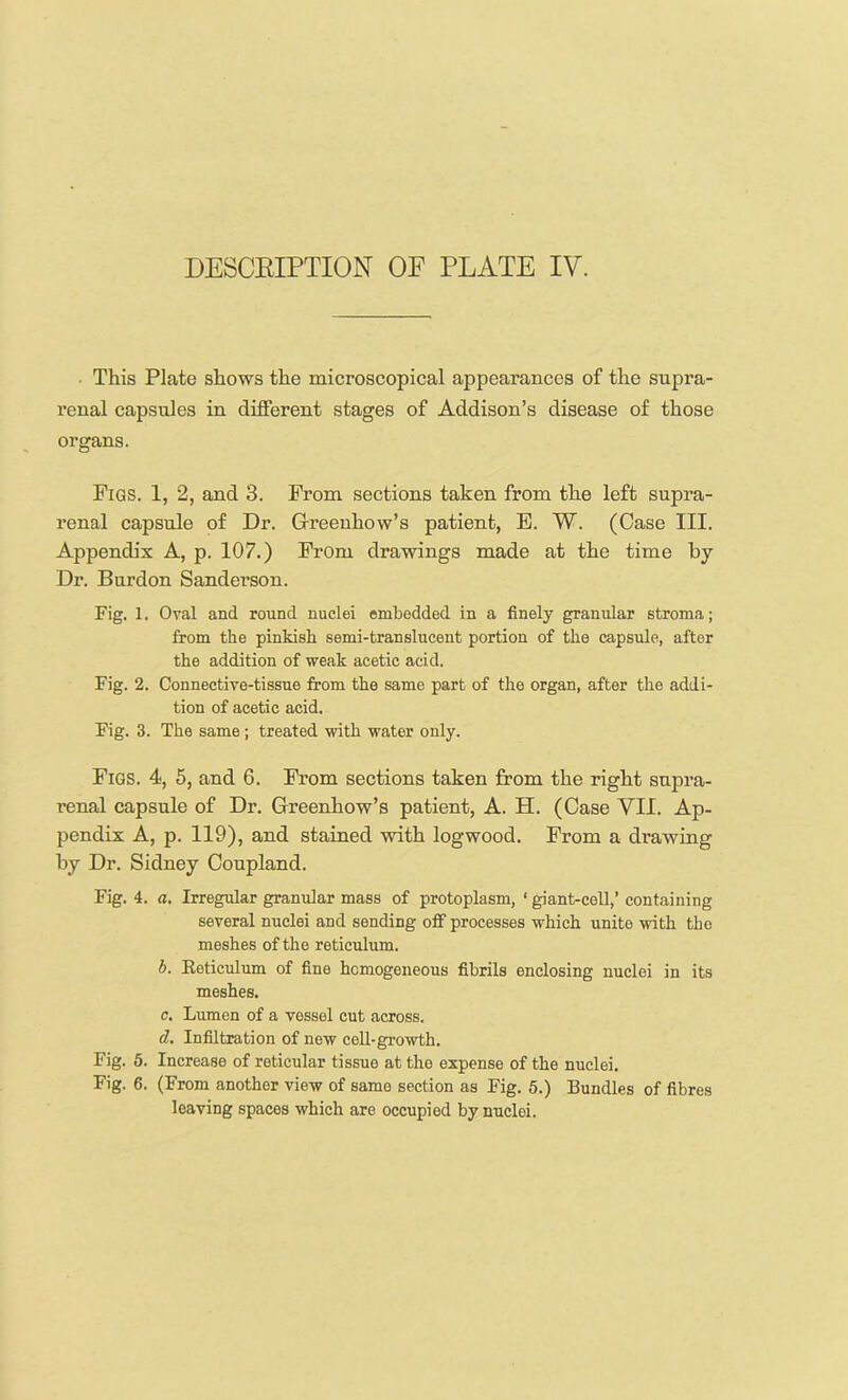 • This Plate shows the microscopical appearances of the supra- renal capsules in different stages of Addison’s disease of those organs. Figs. 1, 2, and 3. From sections taken from the left supra- renal capsule of Dr. Grreeuhow’s patient, E. W. (Case III. Appendix A, p. 107.) From drawings made at the time by Dr. Burden Sanderson. Fig. 1. Oval and round nuclei embedded in a finely granular stroma; from the pinkish semi-translucent portion of the capsule, after the addition of weak acetic acid. Fig. 2. Connective-tissue from the same part of the organ, after the addi- tion of acetic acid. Fig. 3. The same ; treated with water only. Figs. 4, 5, and 6. From sections taken from the right supra- renal capsule of Dr. Greenhow’s patient, A. H. (Case VII. Ap- pendix A, p. 119), and stained with logwood. From a drawing by Dr. Sidney Coupland. Fig. 4. a. Irregular granular mass of protoplasm, ‘ giant-cell,’ containing several nuclei and sending off processes which unite with the meshes of the reticulum. b. Keticidum of fine homogeneous fibrils enclosing nuclei in its meshes. c. Lumen of a vessel cut across. d. Infiltration of new ceU-growth. Fig. 5. Increase of reticular tissue at the expense of the nuclei. Fig. 6. (From another view of same section as Fig. 5.) Bundles of fibres leaving spaces which are occupied by nuclei.