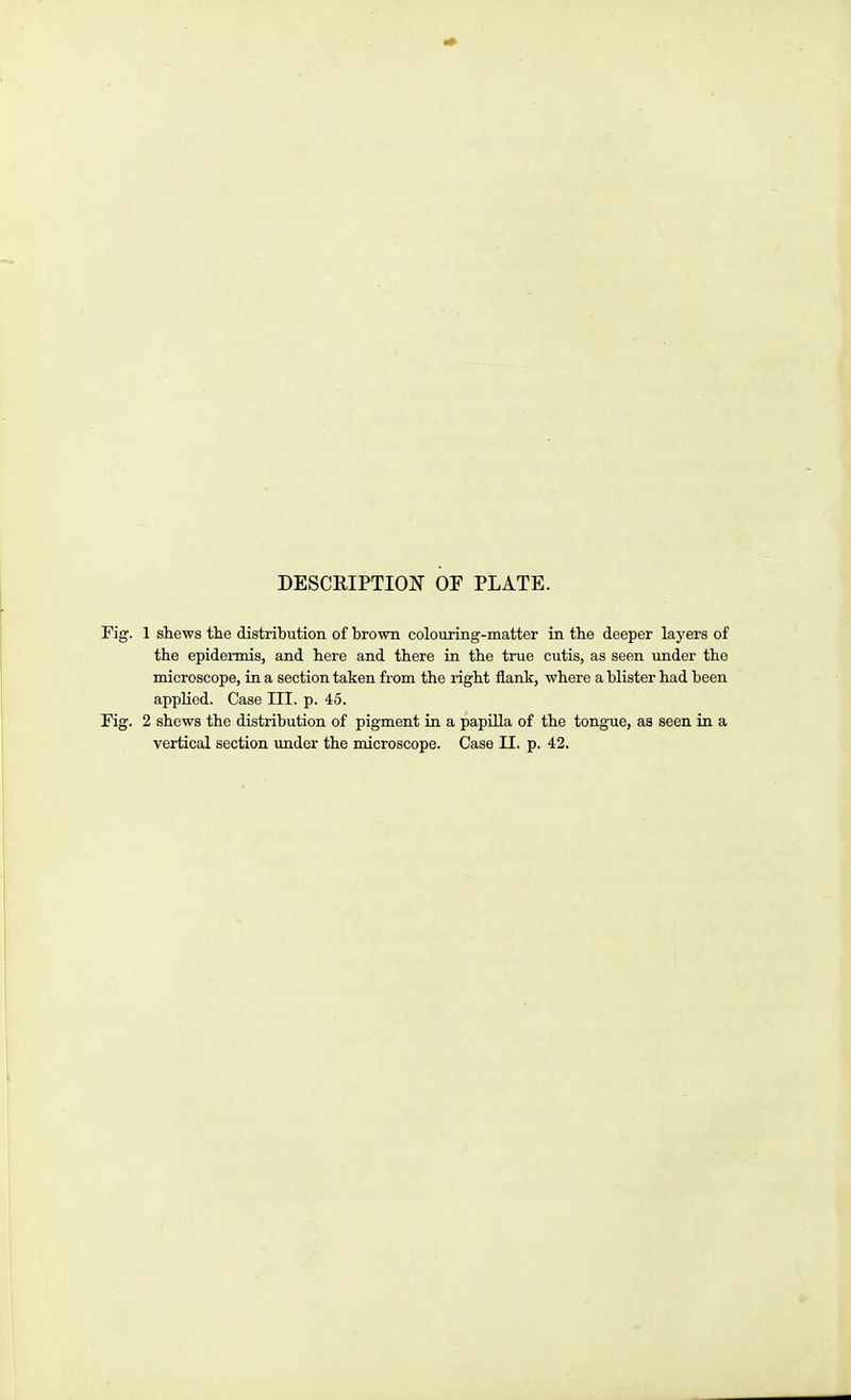 DESCRIPTIOTf OF PLATE. Fig. 1 shews the distribution of brown colouring-matter in the deeper layers of the epidermis, and here and there in the true cutis, as seen under the microscope, in a section taken from the right flank, where a blister had been applied. Case III. p. 45. Fig. 2 shews the distribution of pigment in a papOla of the tongue, as seen in a vertical section under the microscope. Case II. p. 42.