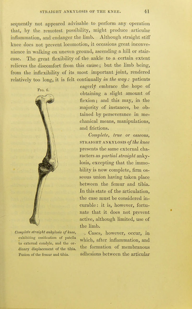 Fig. 6. sequently not appeared advisable to perform any operation that, by the remotest possibility, might produce articular inflammation, and endanger the limb. Although straight stiff knee does not prevent locomotion, it occasions great inconve- nience in walking on uneven ground, ascending a hill or stair- case. The great flexibiHty of the ankle to a certain extent relieves the discomfort from this cause; but the limb being, from the inflexibiHty of its most important joint, rendered relatively too long, it is felt continually in the way : patients eagerly embrace the hope of --^ obtaining a slight amount of flexion; and this may, in the majority of instances, be ob- tained by perseverance in me- chanical means, manipulations, and frictions. Complete, true or osseous, STRAIGHT ANKYLOSIS of the knee presents the same external cha- racters as partial straight anky- losis, excepting that the immo- bility is now complete, firm os- seous union having taken place between the femur and tibia. In this state of the articulation, the case must be considered in- curable: it is, however, fortu- nate that it does not prevent active, although limited, use of the limb. Complete straight ankylosis of knee, ^ Cases, however, OCCUr, in exhibiting ossification of patella i • i • n i * which, alter mnammation, and to external condyle, and the or- dinary displacement of the tibia, ^ke formation of membranous Fusion of the femur and tibia. adhesions between the articular