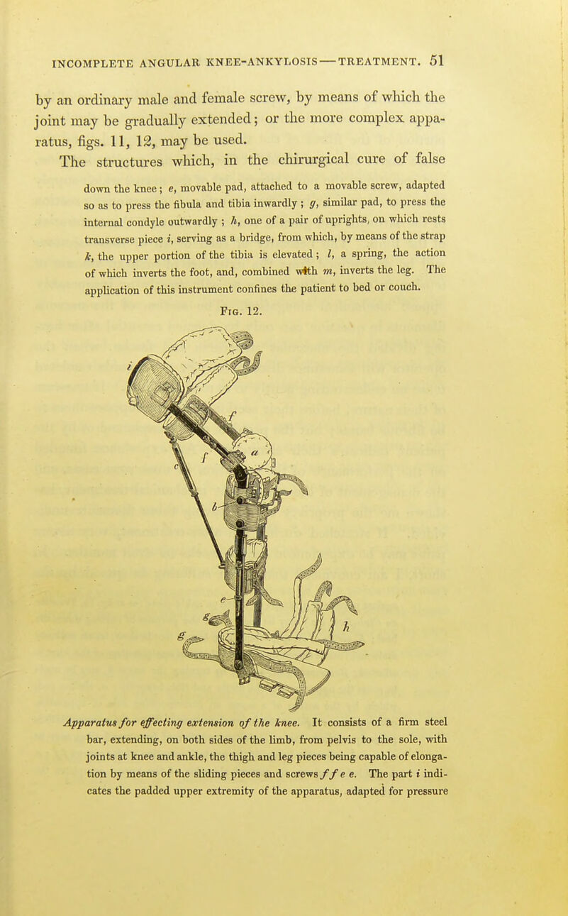 by an ordinary male and female screw, by means of which the joint may be gradually extended; or the more complex appa- ratus, figs. 11, 12, may be used. The structures which, in the chirurgical cure of false down the knee ; e, movable pad, attached to a movable screw, adapted so as to press the fibula and tibia inwardly ; g, similar pad, to press the internal condyle outwardly ; h, one of a pair of uprights, on which rests transverse piece i, serving as a bridge, from which, by means of the strap k, the upper portion of the tibia is elevated; I, a spring, the action of which inverts the foot, and, combined w*th m, inverts the leg. The application of this instrument confines the patient to bed or couch. Fig. 12. Apparatus for effecting extension of the knee. It consists of a firm steel bar, extending, on both sides of the limb, from pelvis to the sole, with joints at knee and ankle, the thigh and leg pieces being capable of elonga- tion by means of the sliding pieces and screvrsffe e. The part t indi- cates the padded upper extremity of the apparatus, adapted for pressure