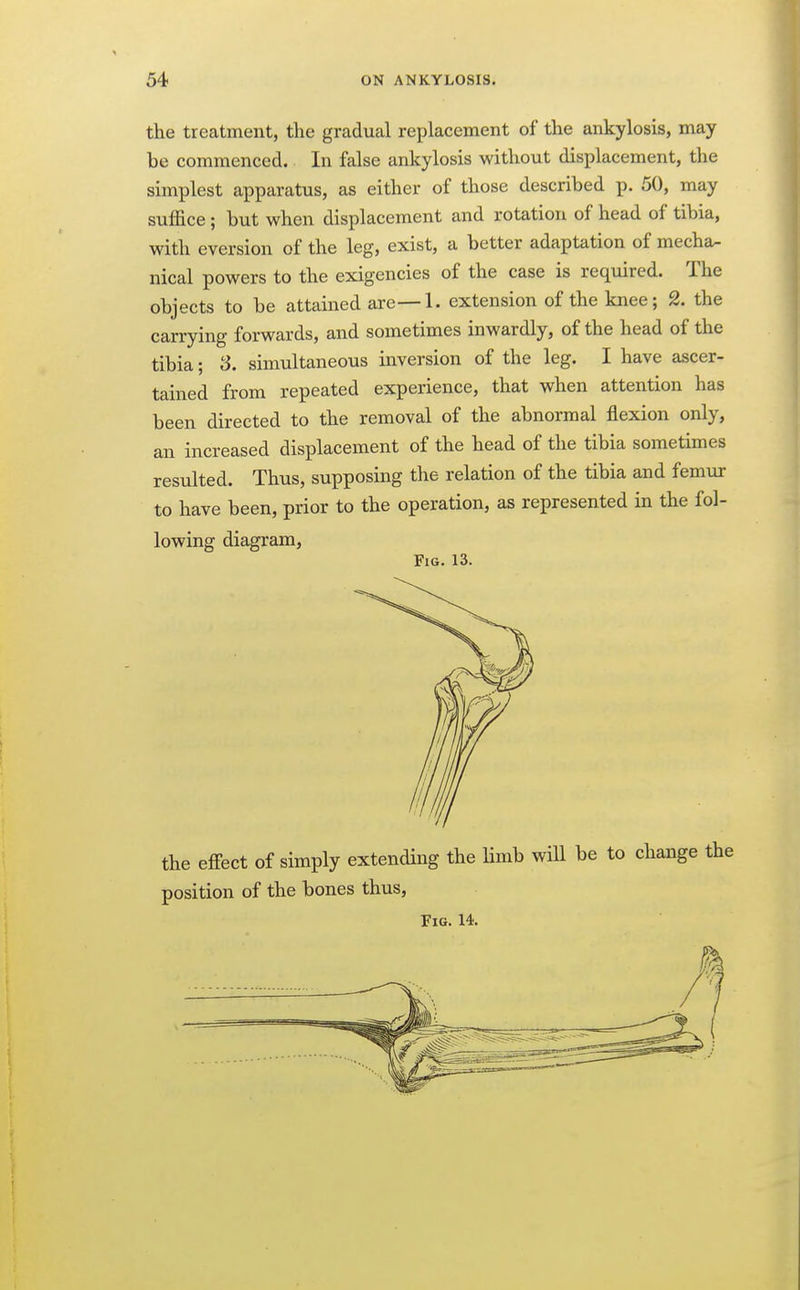 54 ON ANKYLOSIS. the treatment, the gradual replacement of the ankylosis, may be commenced. In false ankylosis without displacement, the simplest apparatus, as either of those described p. 50, may suffice; but when displacement and rotation of head of tibia, with eversion of the leg, exist, a better adaptation of mecha- nical powers to the exigencies of the case is required. The objects to be attained are—1. extension of the knee; 2. the carrying forwards, and sometimes inwardly, of the head of the tibia; S. simultaneous inversion of the leg. I have ascer- tained from repeated experience, that when attention has been directed to the removal of the abnormal flexion only, an increased displacement of the head of the tibia sometimes resulted. Thus, supposing the relation of the tibia and femur to have been, prior to the operation, as represented in the fol- lowing diagram, Fig. 13. the effect of simply extending the limb will be to change the position of the bones thus. Fig. 14.