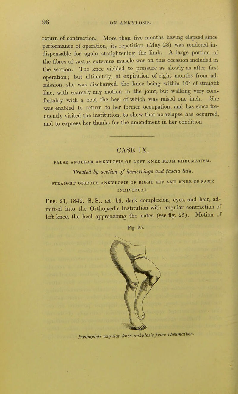 return of contraction. More than five months having elapsed since performance of operation, its repetition (May 28) vi^as rendered in- dispensable for again straightening the limb. A large portion of the fibres of vastus externus muscle was on this occasion included in the section. The knee yielded to pressure as slowly as after first operation; but tdtimately, at expiration of eight months from ad- mission, she was discharged, the knee being within 10° of straight line, with scarcely any motion in the joint, but walking very com- fortably with a boot the heel of which was raised one inch. She was enabled to return to her former occupation, and has since fre- quently visited the institution, to shew that no relapse has occurred, and to express her thanks for the amendment in her condition. FALSE ANGULAR ANKYLOSIS OF LEFT KNEE FROM RHEUMATISM. Treated hy section of hamstrings and fascia lata. STRAIGHT OSSEOUS ANKYLOSIS OF RIGHT HIP AND KNEE OF SAME Feb. 21, 1842. S. S., set. 16, dark complexion, eyes, and hair, ad- mitted into the Orthopaedic Institution with angular contraction of left knee, the heel approaching the nates (see fig. 25). Motion of CASE IX. INDIVIDUAL. Fig. 25. Incomplete angular knee-ankylosis from rheumatism.