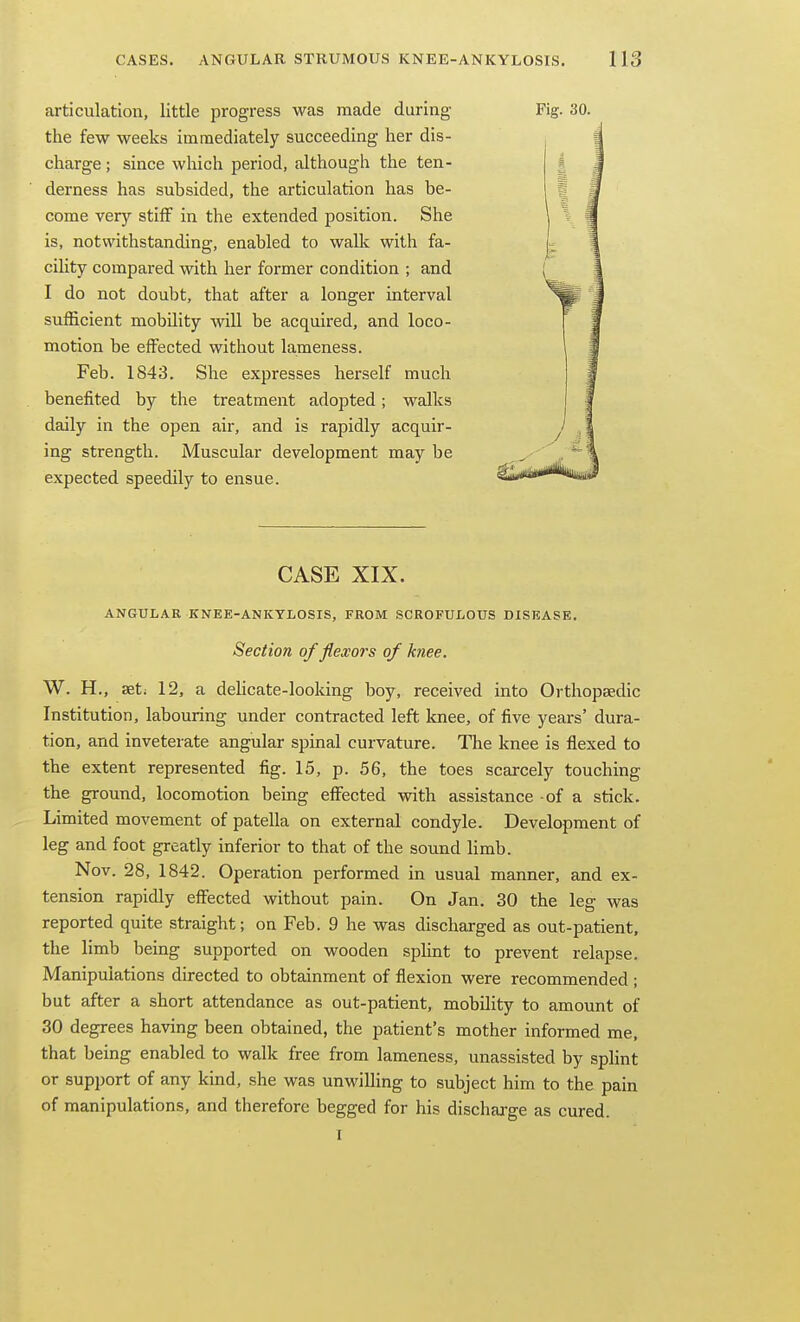articulation, little progress was made during- the few weeks immediately succeeding her dis- charge ; since which period, although the ten- derness has subsided, the articulation has be- come very stiff in the extended position. She is, notwithstanding, enabled to walk with fa- cility compared with her former condition ; and I do not doubt, that after a longer interval sufficient mobility will be acquired, and loco- motion be effected without lameness. Feb. 1843. She expresses herself much benefited by the treatment adopted; walks daily in the open air, and is rapidly acquir- ing strength. iVIuscular development may be expected speedily to ensue. CASE XIX. ANGULAR KNEE-ANKYLOSIS, FROM SCROFULOUS DISEASE. Section of flexors of knee. W. H., asti 12, a deUcate-looking boy, received into Orthopaedic Institution, labouring under contracted left knee, of five years' dura- tion, and inveterate angular spinal curvature. The knee is flexed to the extent represented fig. 15, p. 56, the toes scarcely touching the ground, locomotion being effected with assistance of a stick. Limited movement of patella on external condyle. Development of leg and foot greatly inferior to that of the sound limb. Nov. 28, 1842. Operation performed in usual manner, and ex- tension rapidly effected without pain. On Jan. 30 the leg was reported quite straight; on Feb. 9 he was discharged as out-patient, the limb being supported on wooden sphnt to prevent relapse. Manipulations directed to obtainment of flexion were recommended ; but after a short attendance as out-patient, mobility to amount of 30 degrees having been obtained, the patient's mother informed me, that being enabled to walk free from lameness, unassisted by splint or support of any kind, she was unwilling to subject him to the pain of manipulations, and therefore begged for his discharge as cured. I