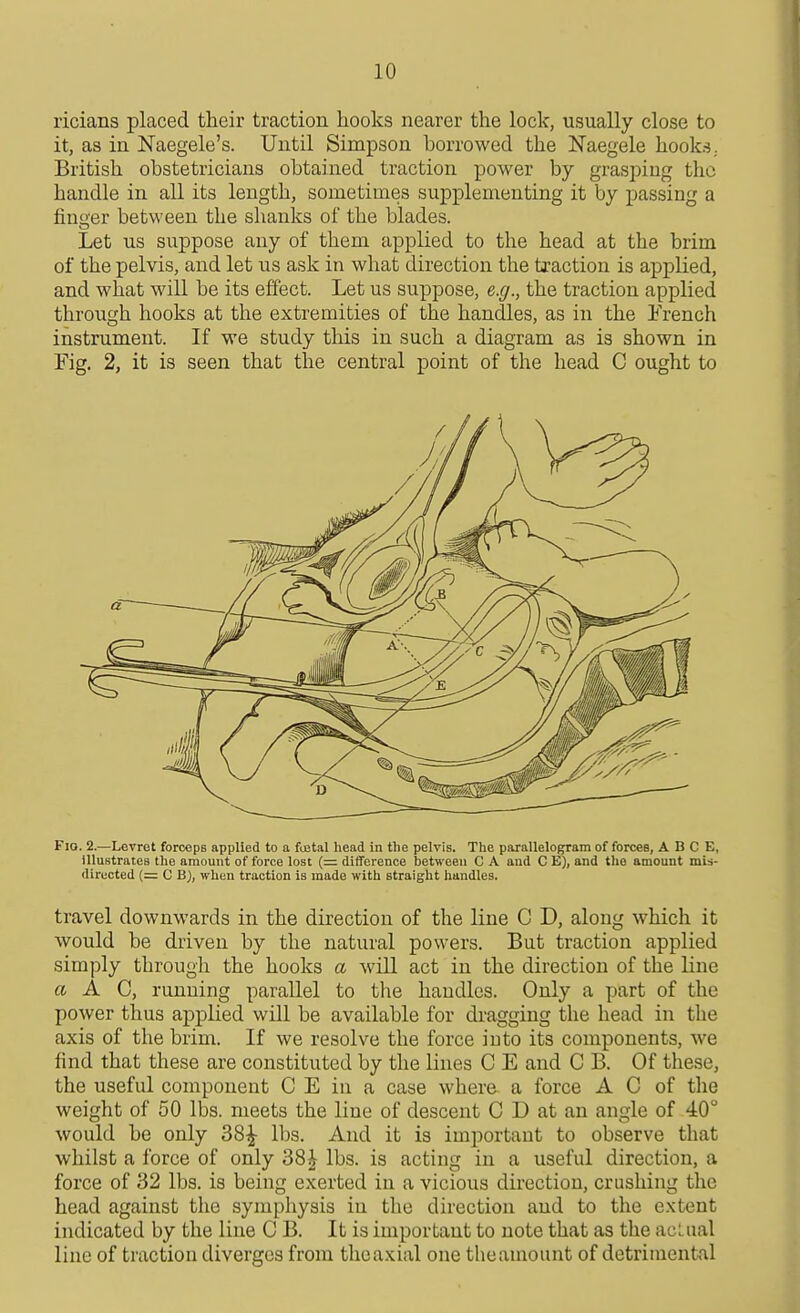 ricians placed their traction liooks nearer the lock, usually close to it, as in Naegele's. Until Simpson borrowed the Naegele hooks. British obstetricians obtained traction power by grasping the handle in all its length, sometimes supplementing it by passing a finger between the shanks of the blades. Let us suppose any of them applied to the head at the brim of the pelvis, and let us ask in what direction the traction is applied, and what will be its effect. Let us suppose, e.g., the traction applied through hooks at the extremities of the handles, as in the Erench instrument. If we study this in such a diagram as is shown in Fig. 2, it is seen that the central point of the head C ought to Fio. 2.—Levrot forceps applied to a festal head in the pelvis. The parallelogram of forces, A B C E, illustrates the amount of force lost (= difference between C A and 0 E), and the amount mis- directed (= C Q), when traction is made with straight handles. travel downwards in the direction of the line G D, along which it would be driven by the natural powers. But traction applied simply through the hooks a will act in the direction of the line a A C, running parallel to tlie handles. Only a part of the power thus applied will be available for dragging the head in the axis of the brim. If we resolve the force into its components, we find that these are constituted by the lines C E and C B. Of these, the useful component C E in a case where a force A C of the weight of 50 lbs. meets the line of descent C D at an angle of 40° would be only 38^ lbs. And it is important to observe that whilst a force of only 38^ lbs. is acting in a useful direction, a force of 32 lbs. is being exerted in a vicious direction, crushing the head against the symphysis in the direction and to the extent indicated by the line C B. It is important to note that as the acLual line of traction diverges from theaxial one theamount of detrimental