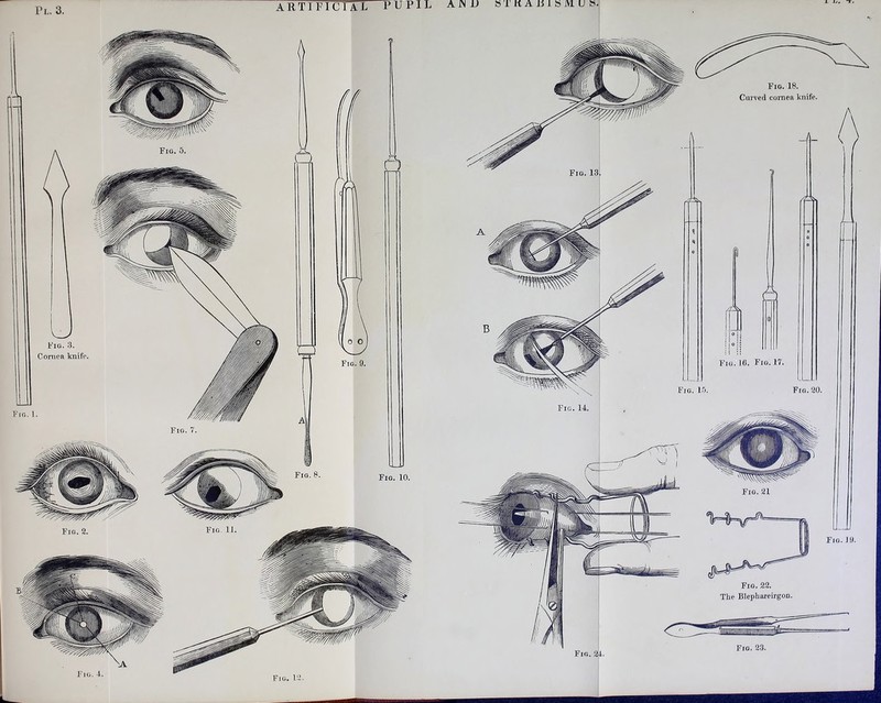 Pl. 3. ARTIFICIAL PU P1 L A JN V ST rlA J5 l s M U S. I iJ, T. Fig. 4. Fig. l'T.