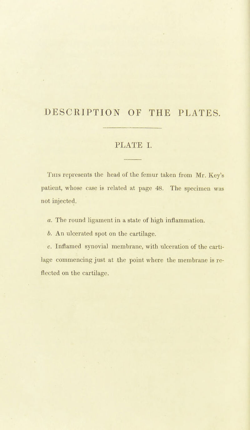 DESCRIPTION OF THE PLATES. PLATE I. This represents the head of the femur taken from Mr. Key's patient, whose case is related at page 48. The specimen was not injected. a. The round ligament in a state of high inflammation. b. An ulcerated spot on the cartilage. c. Inflamed synovial membrane, with ulceration of the carti- lage commencing just at the point where the membrane is re- flected on the cartilage.