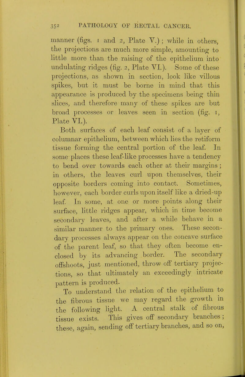 manner (figs, i and 2, Plate V.) ; while in others, the projections are much more simple, amounting to little more than the raising of the epithelium into undulating ridges (fig. 2, Plate VI.). Some of these projections, as shown in section, look like villous spikes, but it must be borne in mind that this appearance is produced by the specimens being thin slices, and therefore many of these spikes are but broad processes or leaves seen in section (fig. i, Plate VI.). Both surfaces of each leaf consist of a layer of columnar epithelium, between which lies the retiform tissue forming the central portion of the leaf. In some-places these leaf-like processes have a tendency to bend over towards each other at their margins ; in others, the leaves curl upon themselves, their opposite borders coming into contact. Sometimes, however, each border curls upon itself like a dried-up leaf In some, at one or more points along their surface, little ridges appear, which in time become secondary leaves, and after a while behave in a similar manner to the primary ones. These secon- dary processes always appear on the concave surface of the parent leaf, so that they often become en- closed by its advancing border. The secondary ofishoots, just mentioned, throw off tertiary projec- tions, so that ultimately an exceedingly intricate pattern is produced. To understand the relation of the epithelium to the fibrous tissue we may regard the growth in the following light. A central stalk of fibrous tissue exists. This gives off secondary branches ; these, again, sending off tertiary branches, and so on,