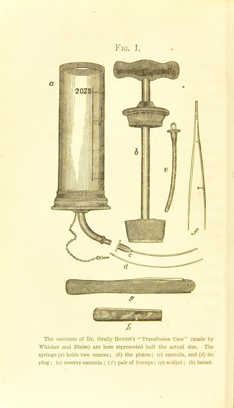 M The (■oiitoiits of Dr. Graily Hewitt's  Transfusion Case (made by Whicker ami Ulniee) nre liere represented liaif the nctnnl size. The syringe (a) holJs two onnccs; (6) the piston ; (<•) cannula, and (rf) its plug; (t) reserve cannula ; (/) pair of foi-ceps; ((7) scaljiel: (A) lancet.